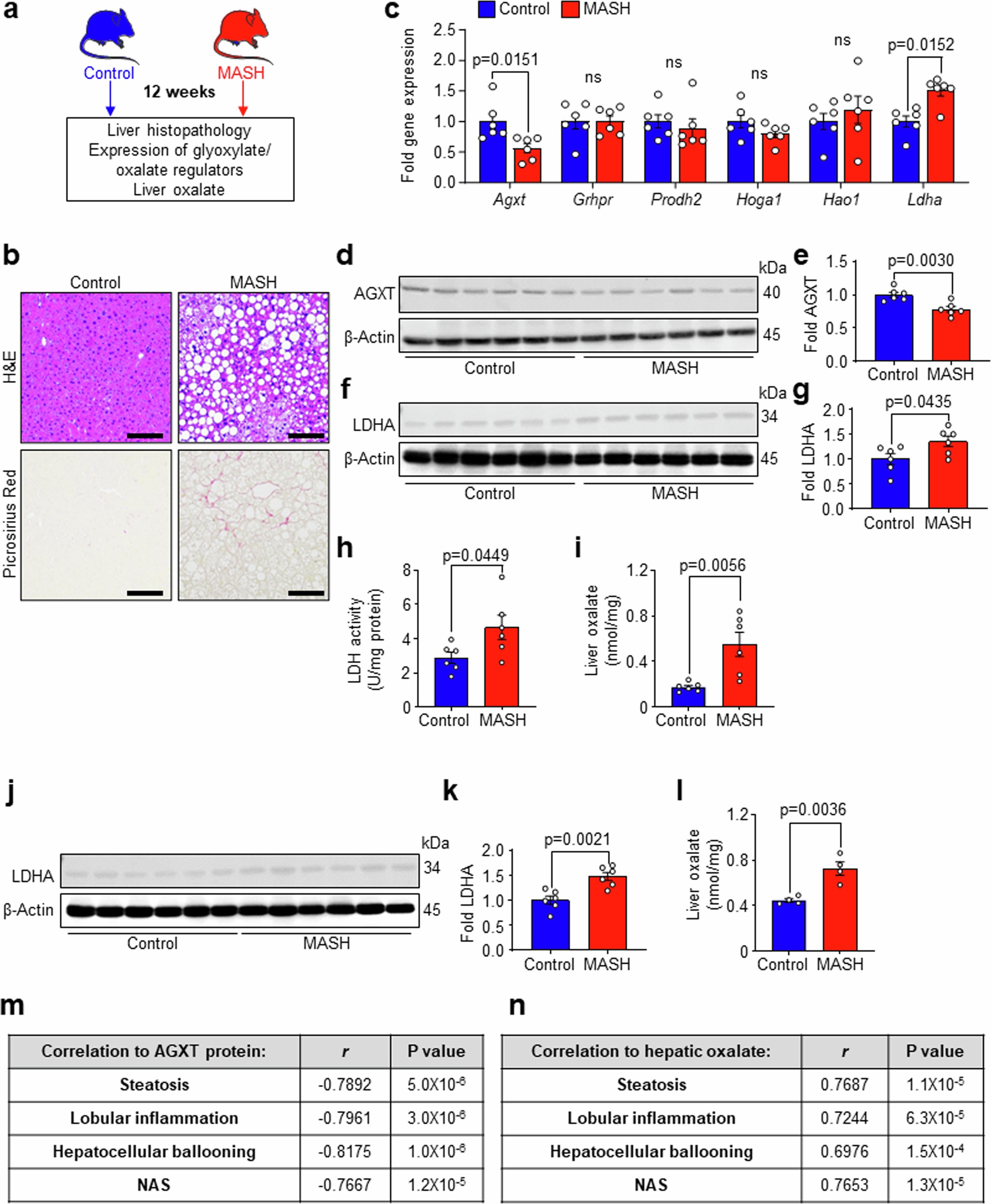 Extended Data Fig. 2: Dysregulated oxalate metabolism in murine MASH.