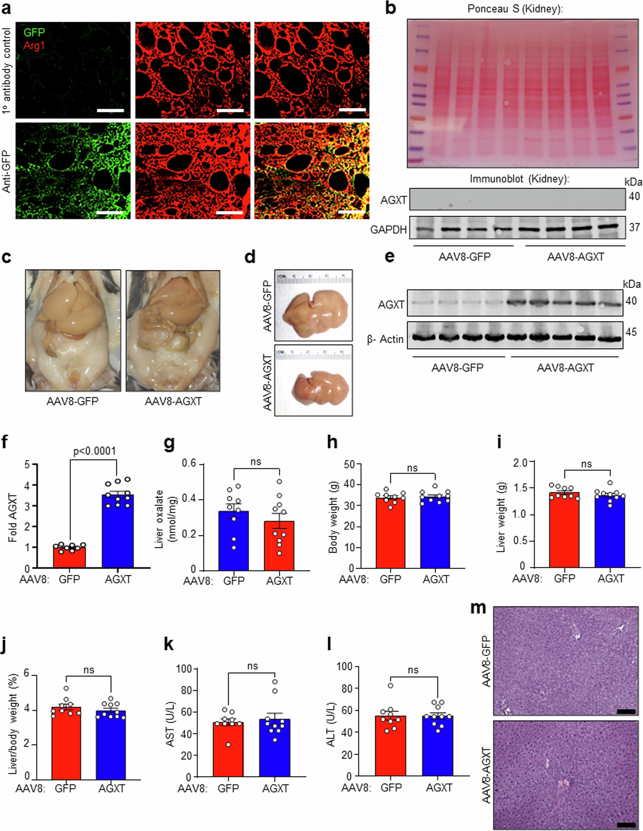 Extended Data Fig. 4: Hepatocyte-specific overexpression of AGXT on MASH or standard chow diet.