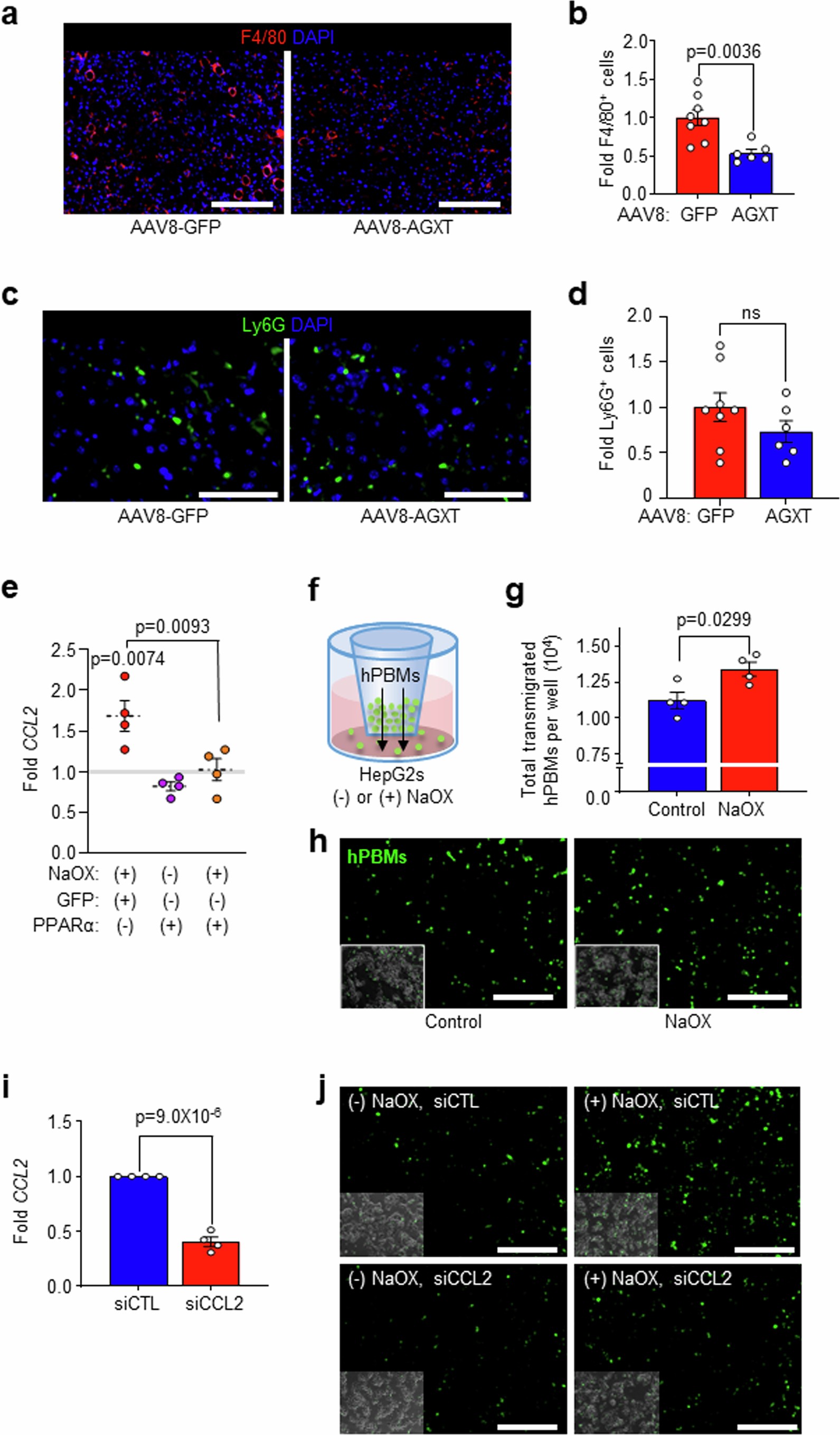 Extended Data Fig. 8: Oxalate lowering via AGXT overexpression reduces hepatic macrophages, while oxalate induces monocyte chemotaxis via CCL2.