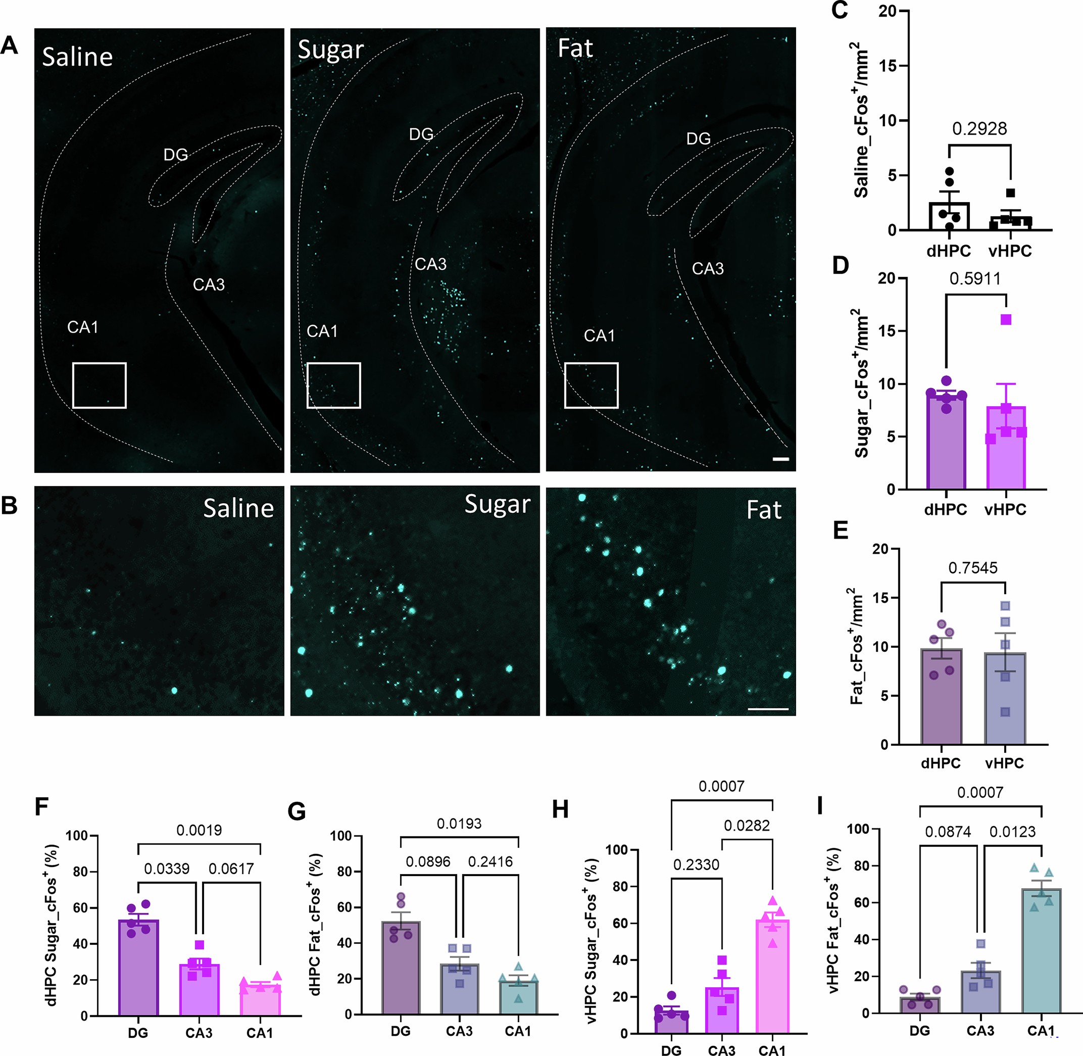 Extended Data Fig. 1: vHPC neuronal responses to IG nutrient infusions.