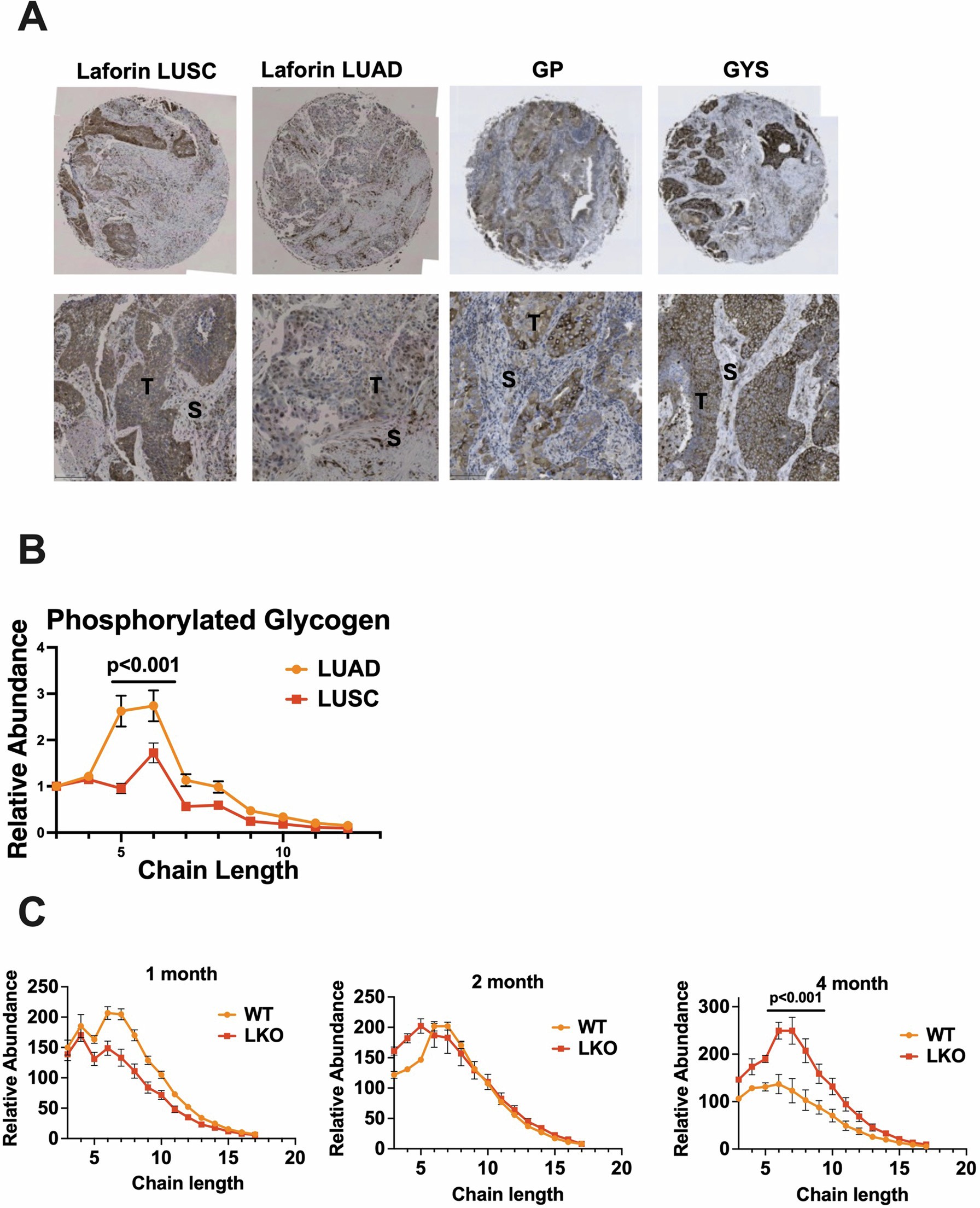 Extended Data Fig. 6: Laforin expression, phosphorylated glycogen analysis, and glycogen dynamics in LKO animals.