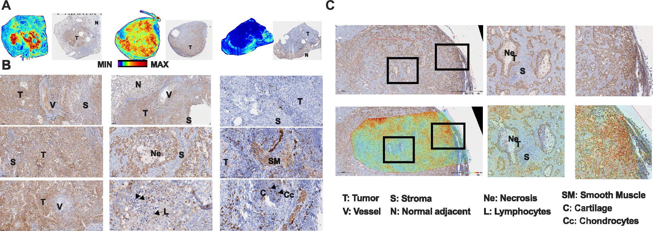 Extended Data Fig. 1: Validation of MALDI glycogen imaging with anti-glycogen antibody staining in lung adenocarcinoma (LUAD) and lung squamous cell carcinoma (LUSC) tissues.