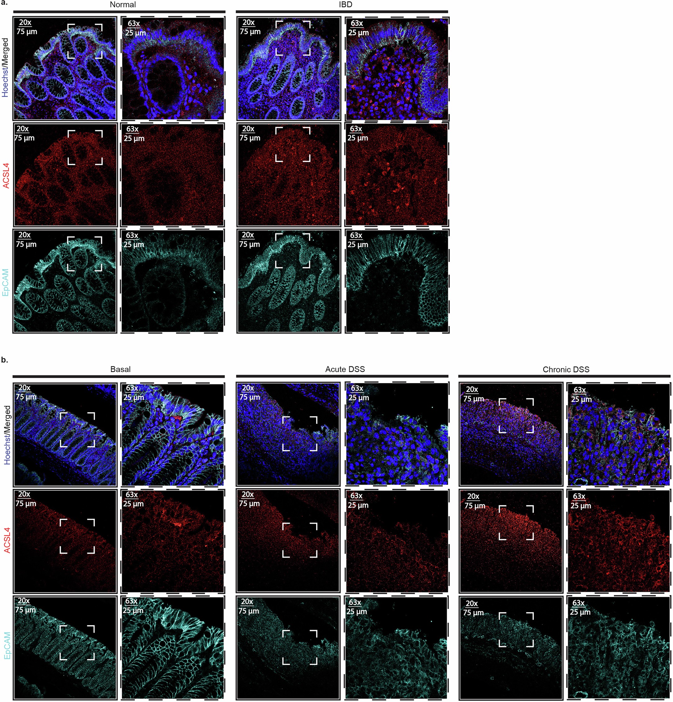 Extended Data Fig. 4: ACSL4 is expressed in epithelial cells.