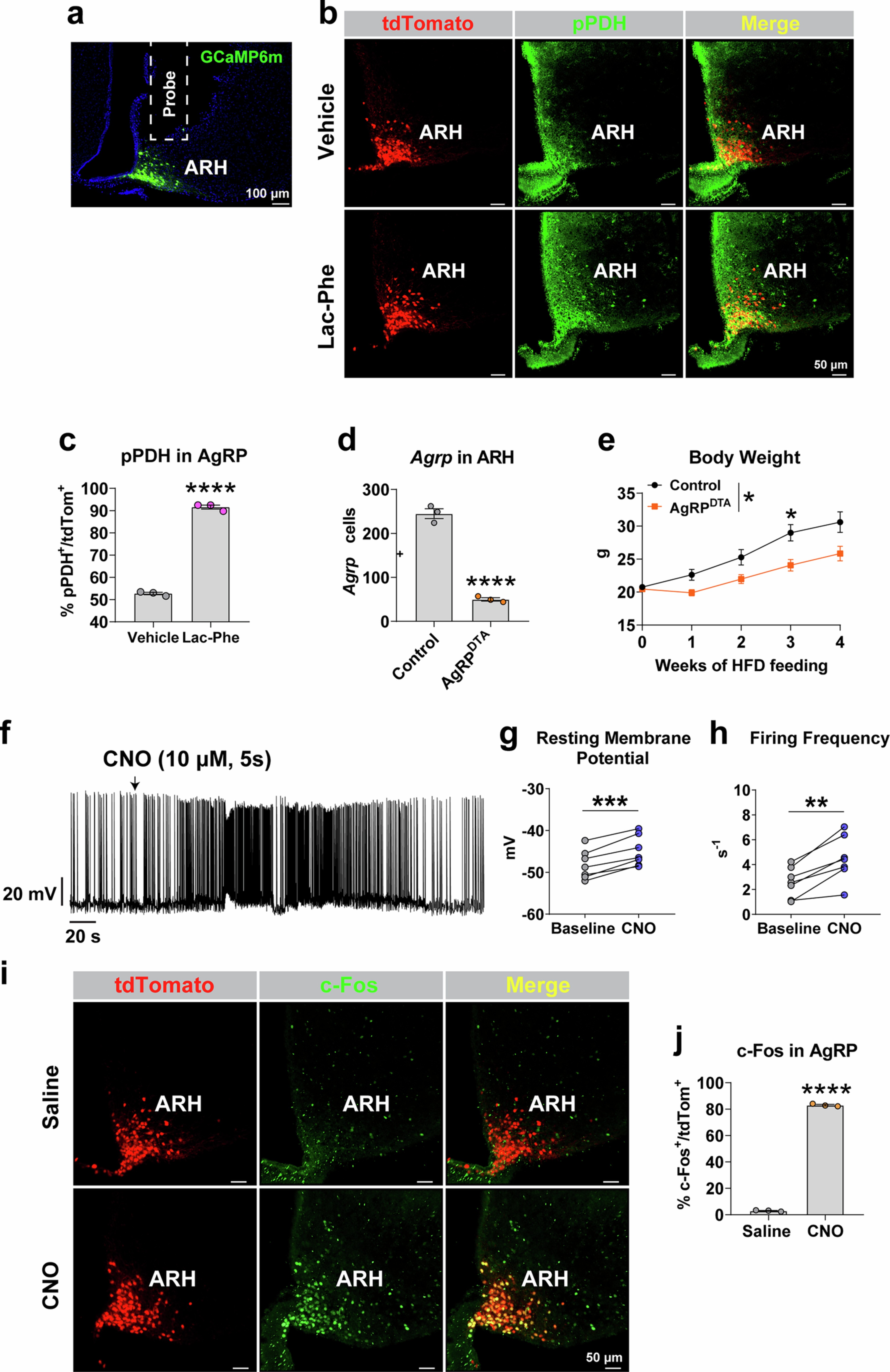Extended Data Fig. 7: AgRP neurons mediate exercise-induced hypophagia.