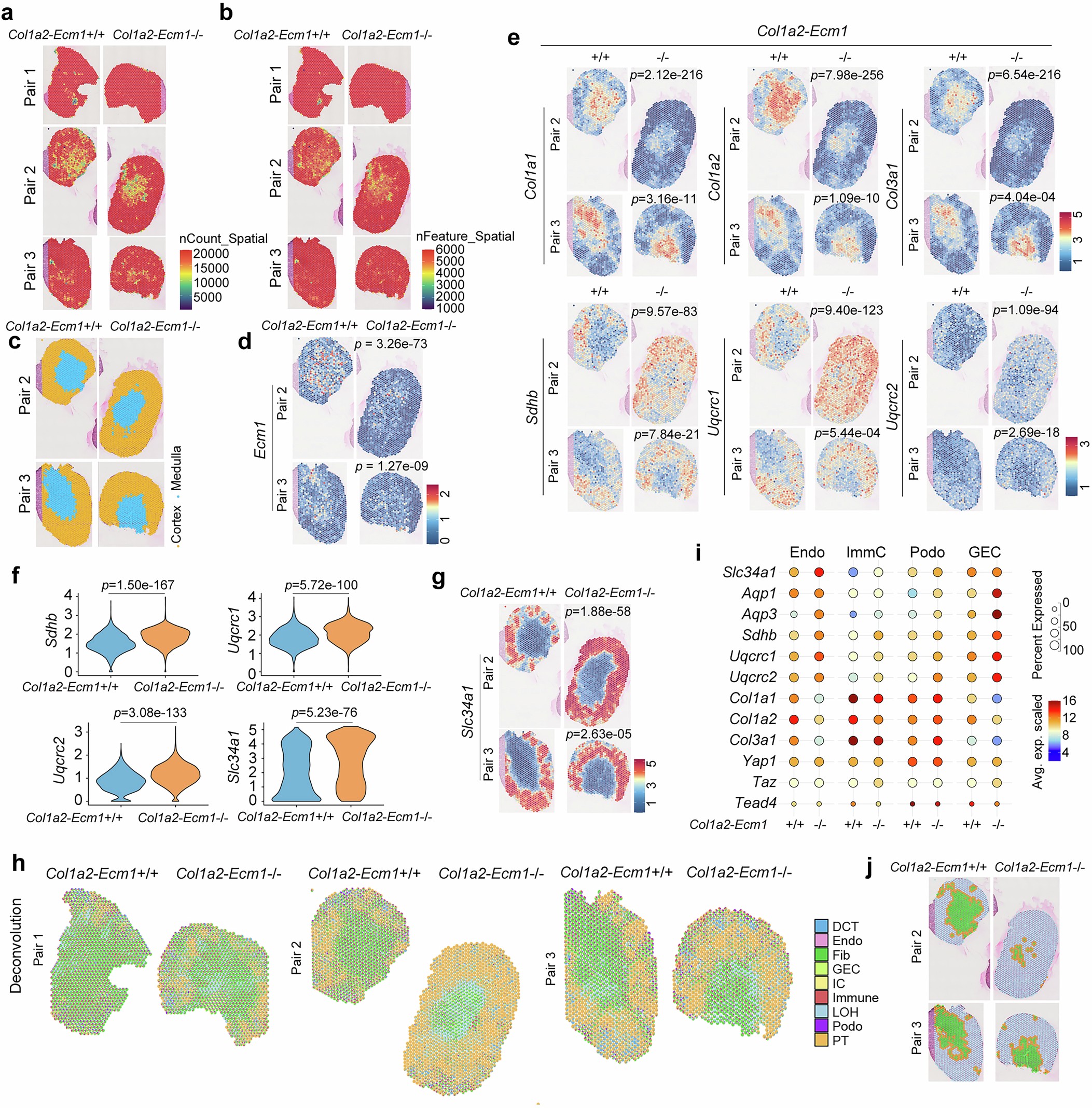 Extended Data Fig. 7: Spatial transcriptomic profiling of Col1α2-Ecm1+/+ and Col1α2-Ecm1-/- fibrotic kidneys.