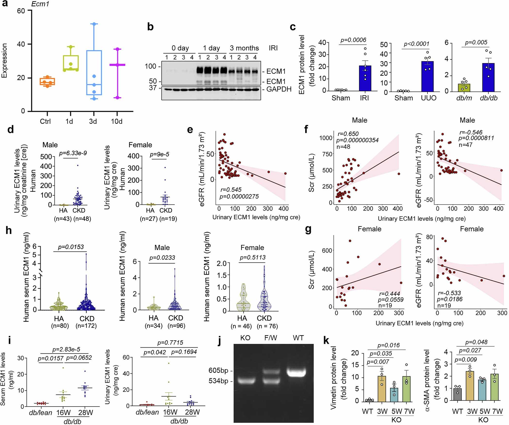 Extended Data Fig. 1: ECM1 expression in human and animal models of CKD.