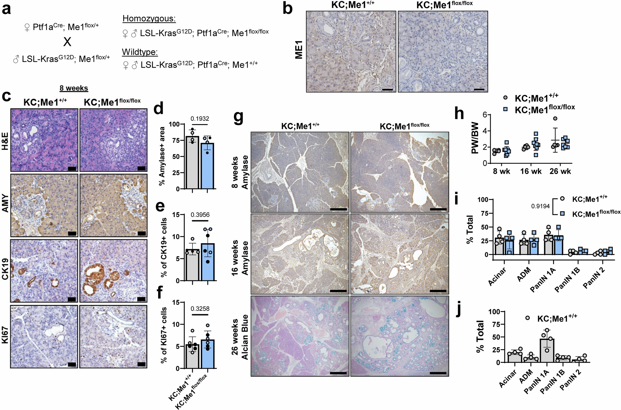 Extended Data Fig. 8: Additional description of and analyses in KC;Me1+/+ and KC;Me1flox/flox mice.