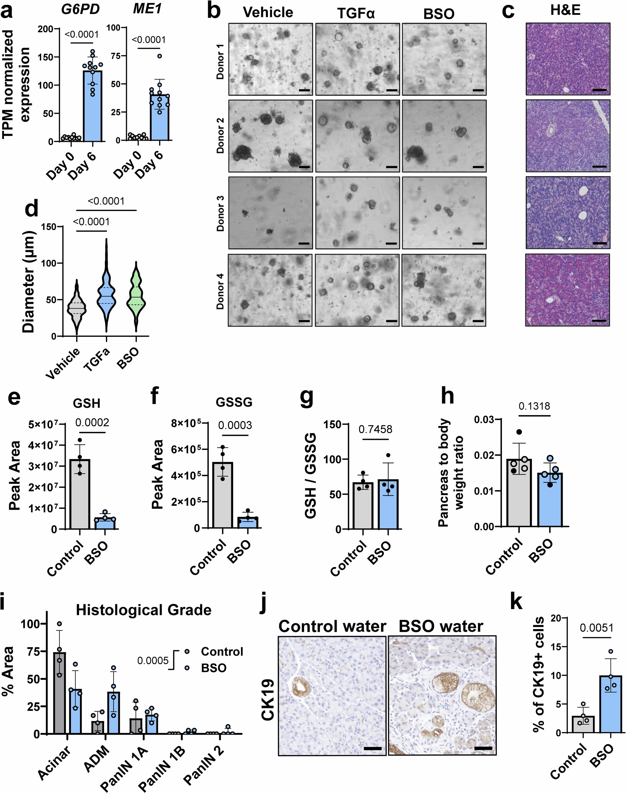 Extended Data Fig. 10: Representative cultures from donor pancreas and additional analyses in BSO-treatment experiments.