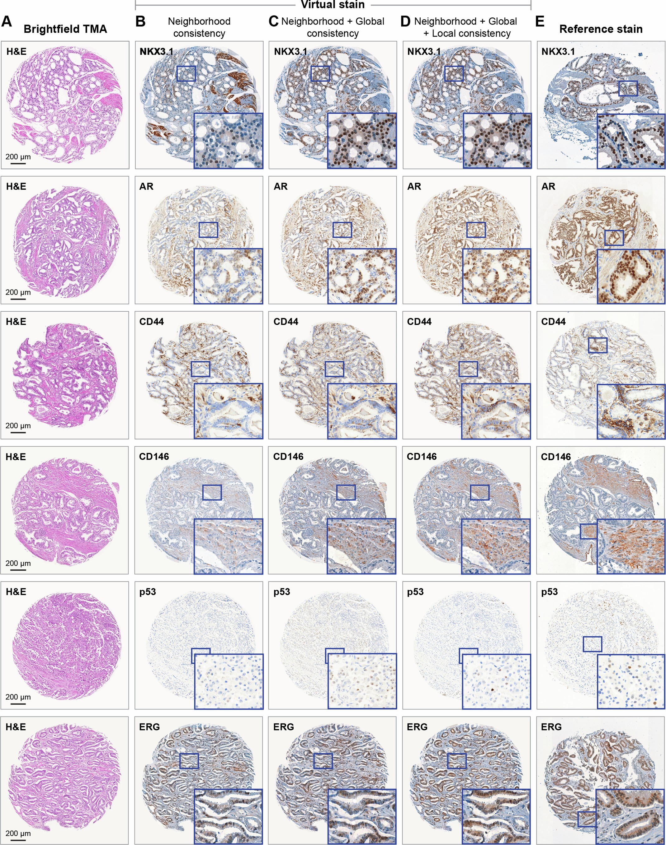 Extended Data Fig. 4: Ablation study.