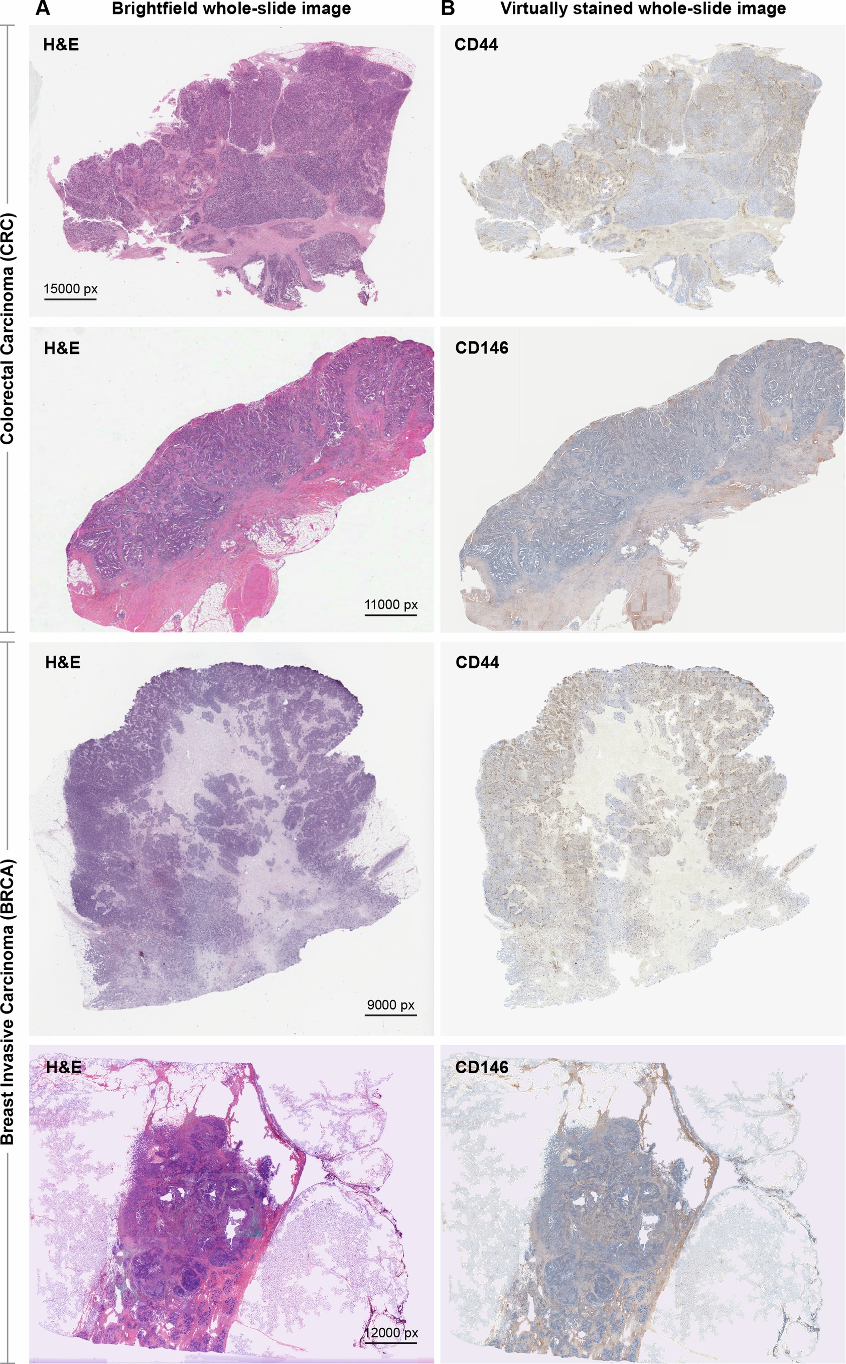 Extended Data Fig. 9: Transfer learning from TMAs to WSIs of different tissue types from TCGA cohort.