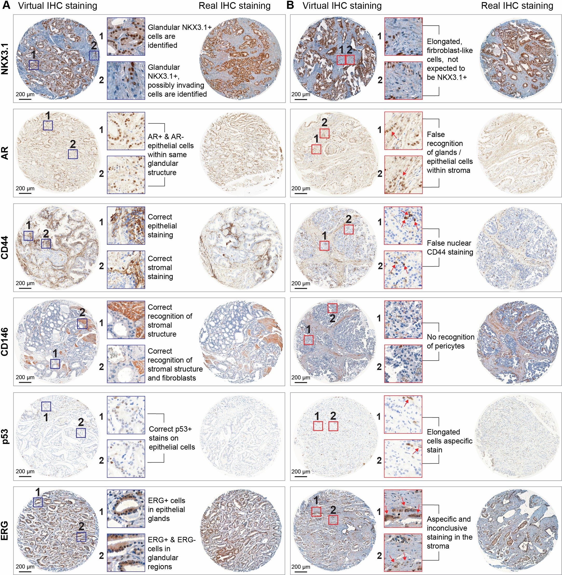 Extended Data Fig. 2: Visual quality assessment of virtually stained IHC images of the EMPaCT prostate cancer TMA.