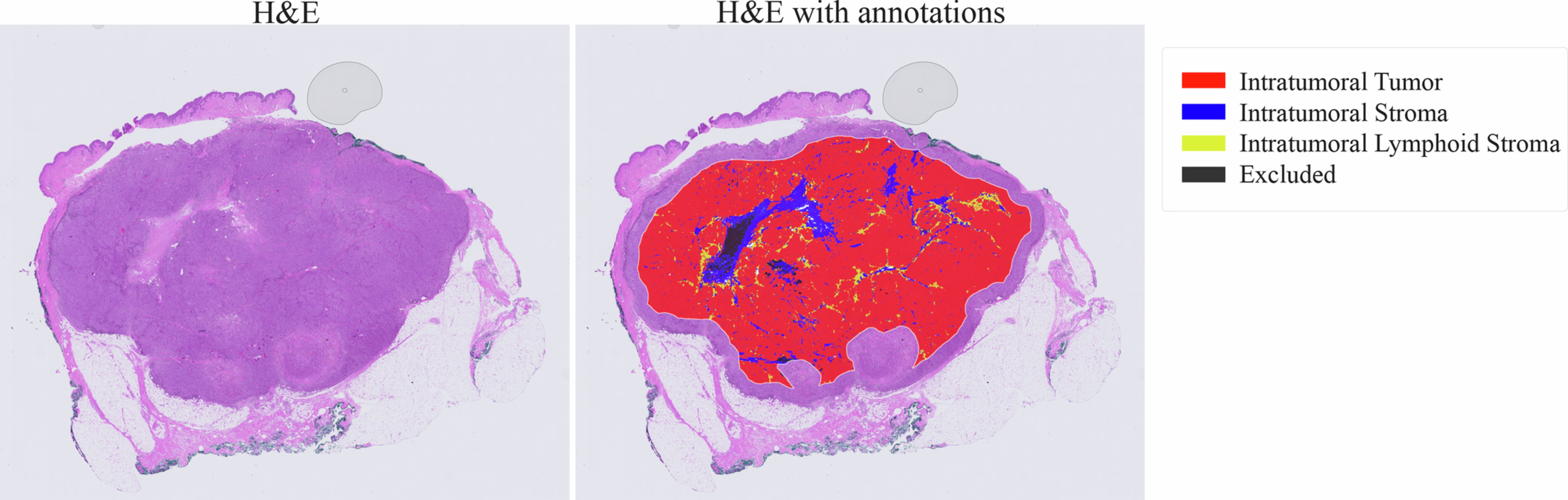 Extended Data Fig. 4: Region annotation for Immune phenotyping.