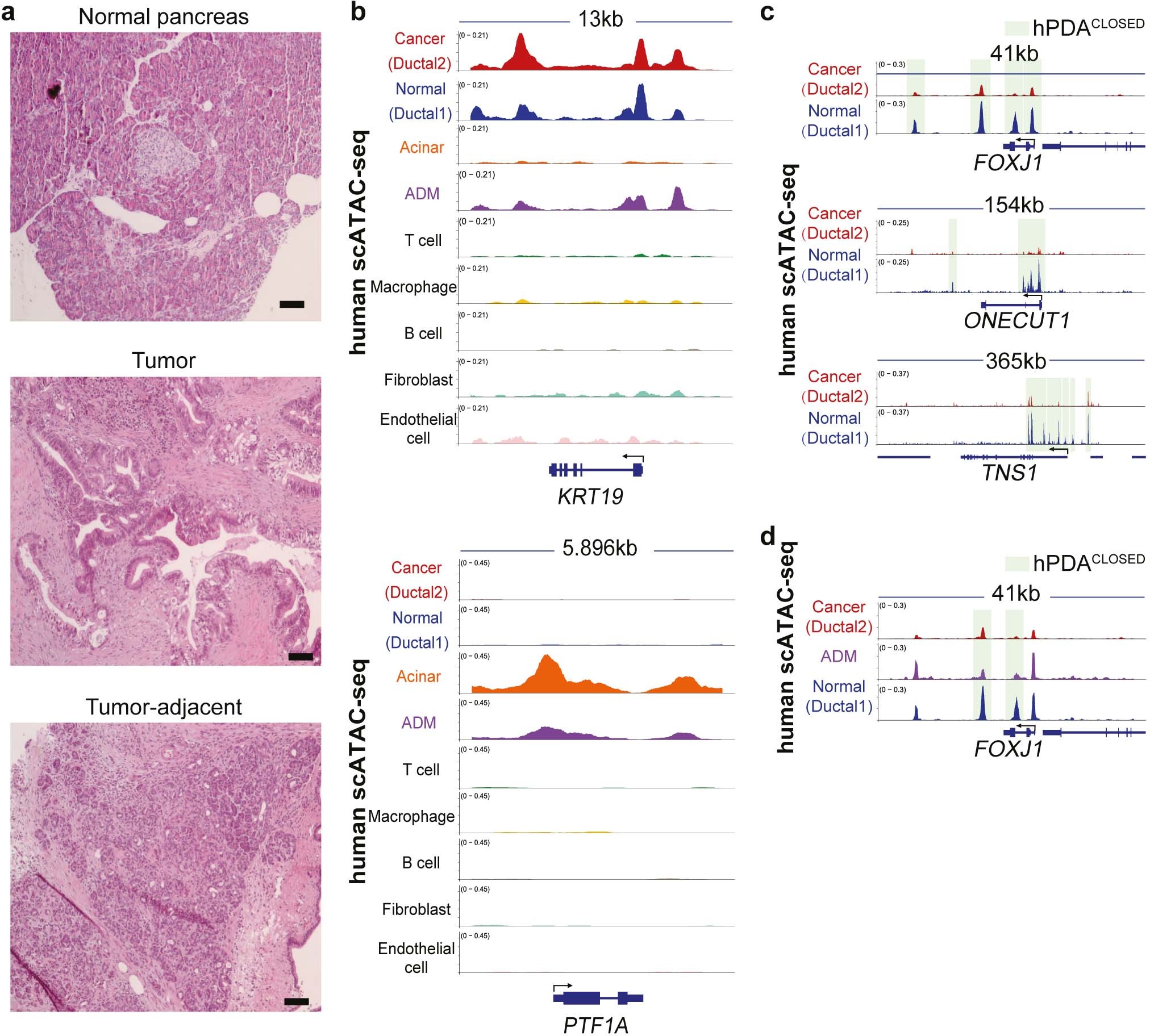Extended Data Fig. 6: Human ADM is readily identified using scATAC-seq.