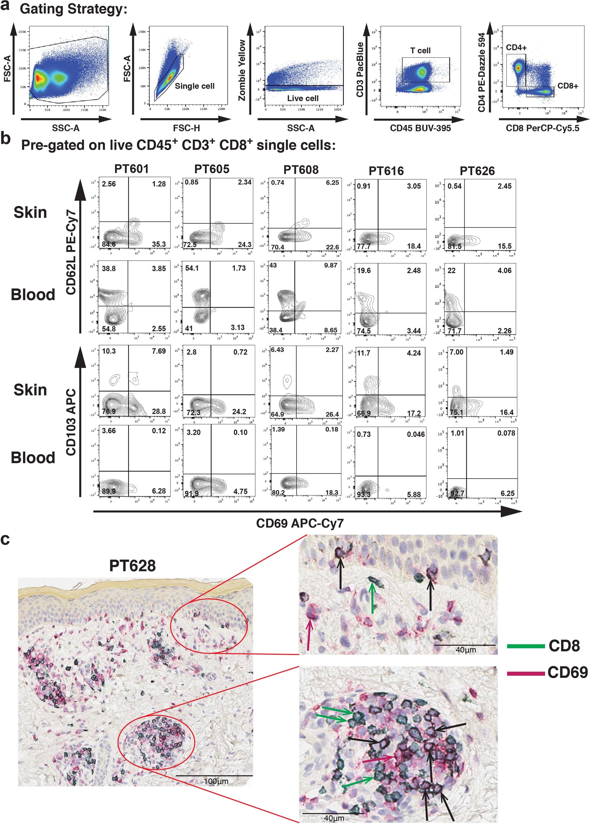 Extended Data Fig. 3: Resident memory CD8+ T cells expressing CD69 reside in both the epidermis and dermis in long-term metastatic melanoma survivors with immunotherapy-associated vitiligo.
