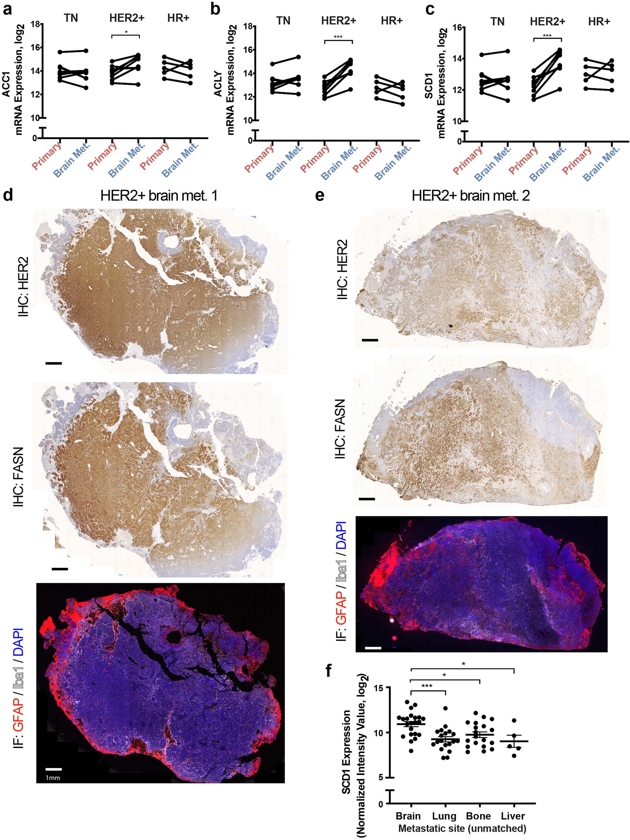 Extended Data Fig. 4: FASN expression is high in breast cancer brain metastases.