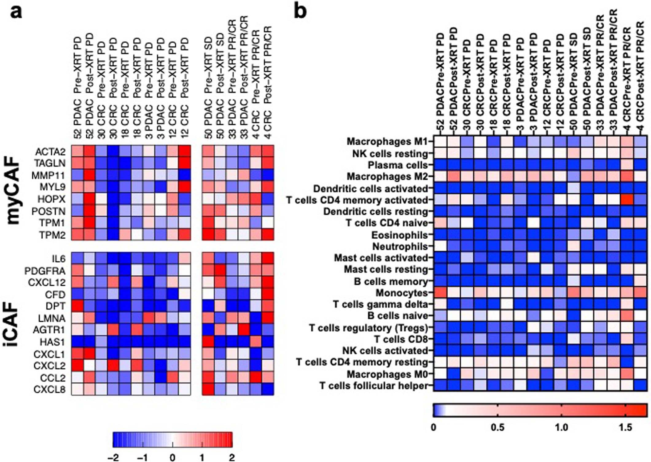 Extended Data Fig. 2: Expression analysis of paired pre-XRT and post-XRT biopsy samples.