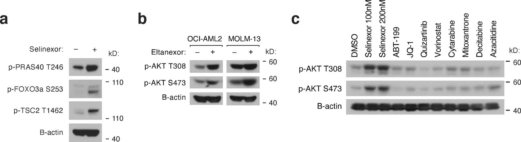 Extended Data Fig. 2: Activation of AKT signaling is a specific consequence of XPO1 inhibition.