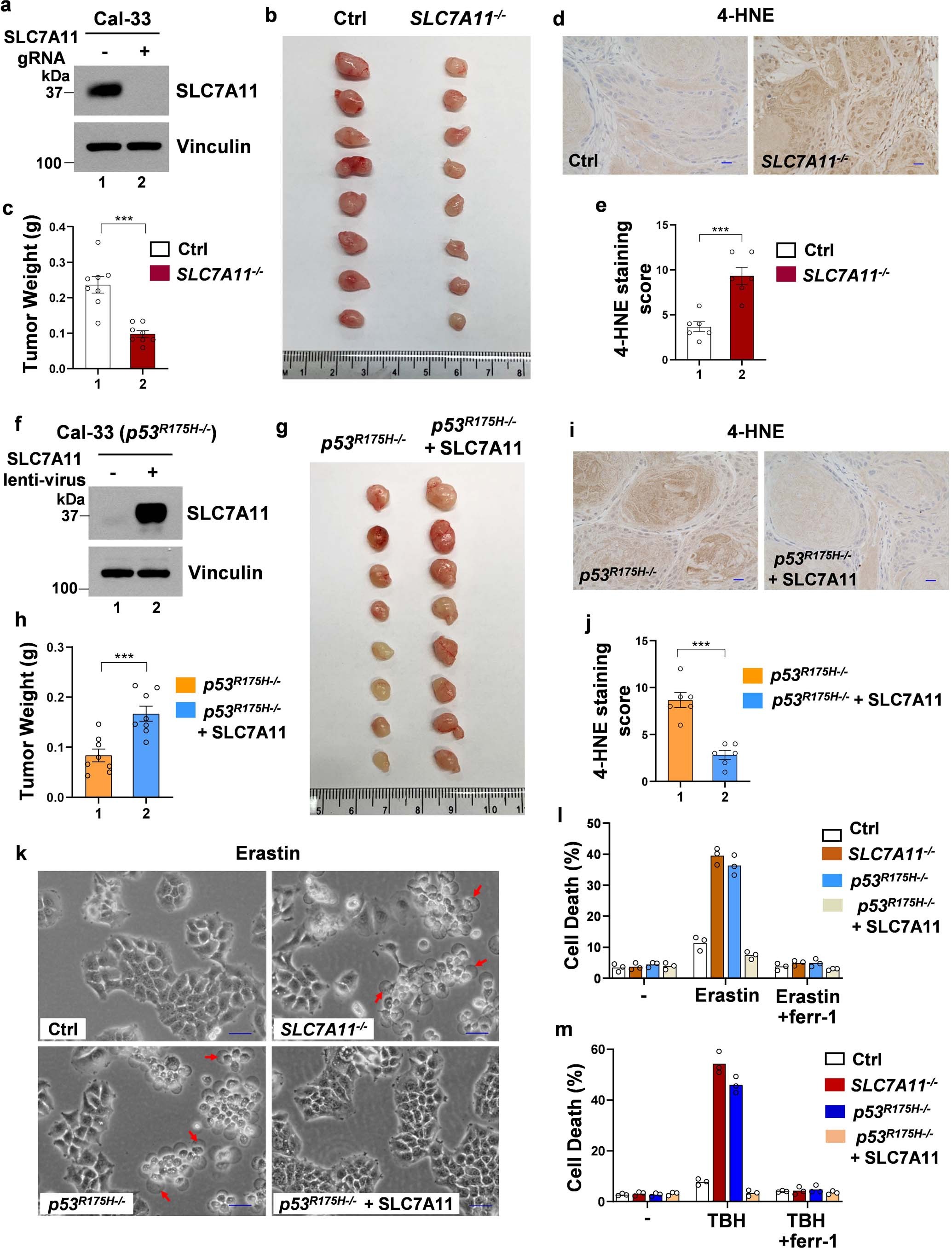 Extended Data Fig. 4: The role of SLC7A11 in p53R175H-mediated inhibition of ferroptosis and promotion of tumor growth.