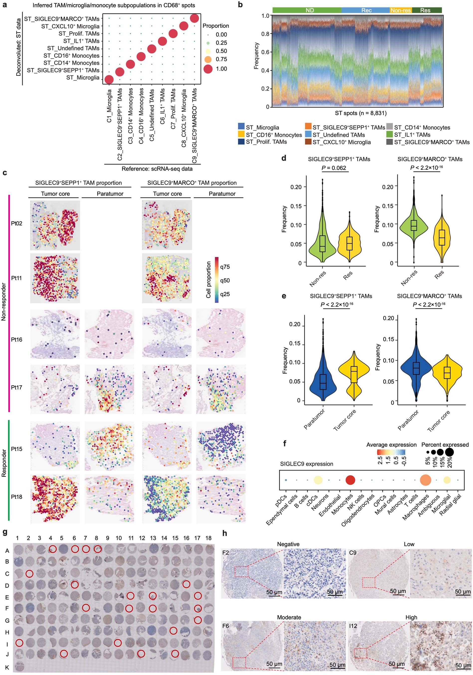 Extended Data Fig. 5: Spatial transcriptomics of TAMs in human GBM, and Siglec-9 expression in tissue microarray including 159 glioma patients.