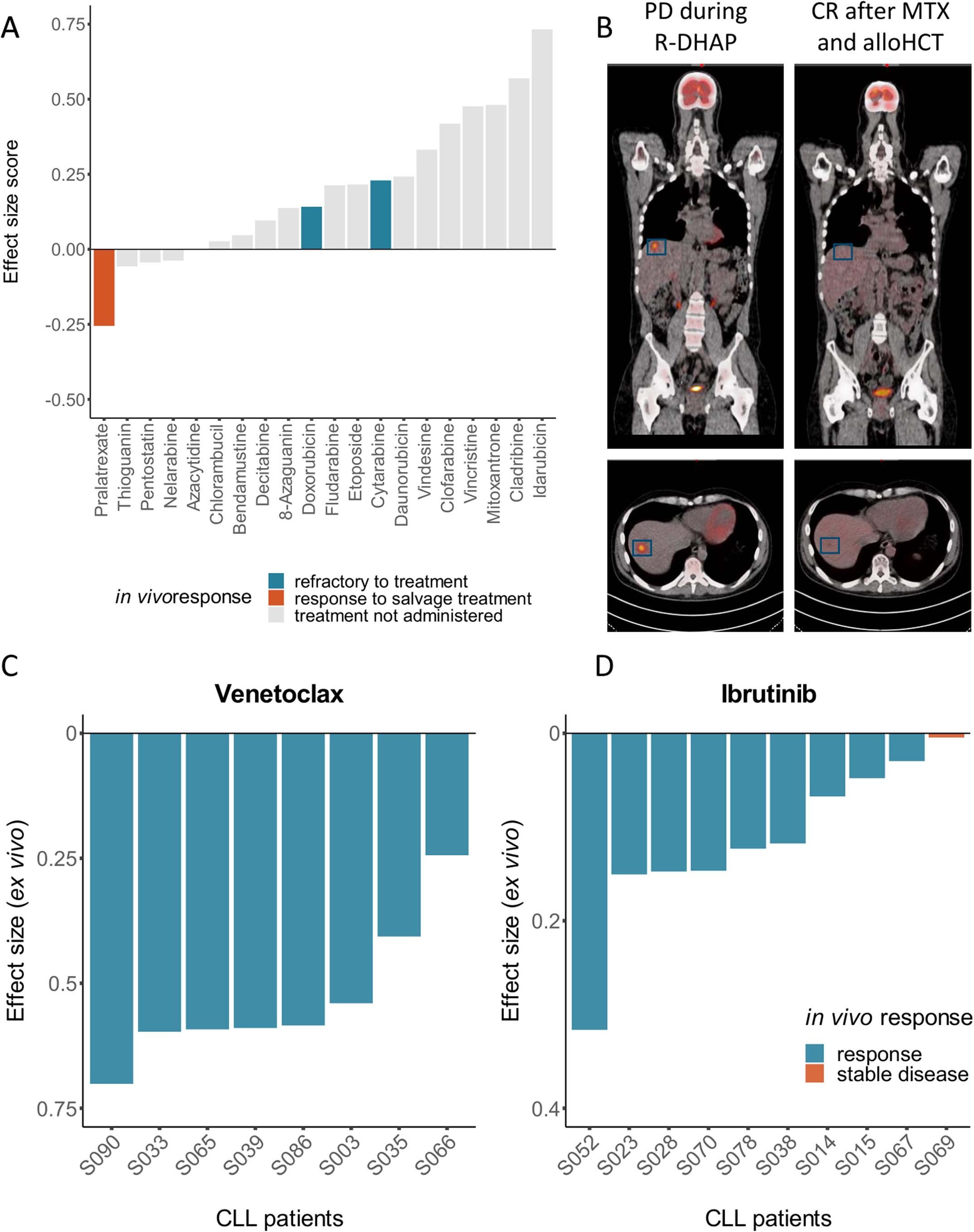 Extended Data Fig. 7: Clinical translation of ex vivo drug response profiling in a patient with highly aggressive refractory Burkitt lymphoma.
