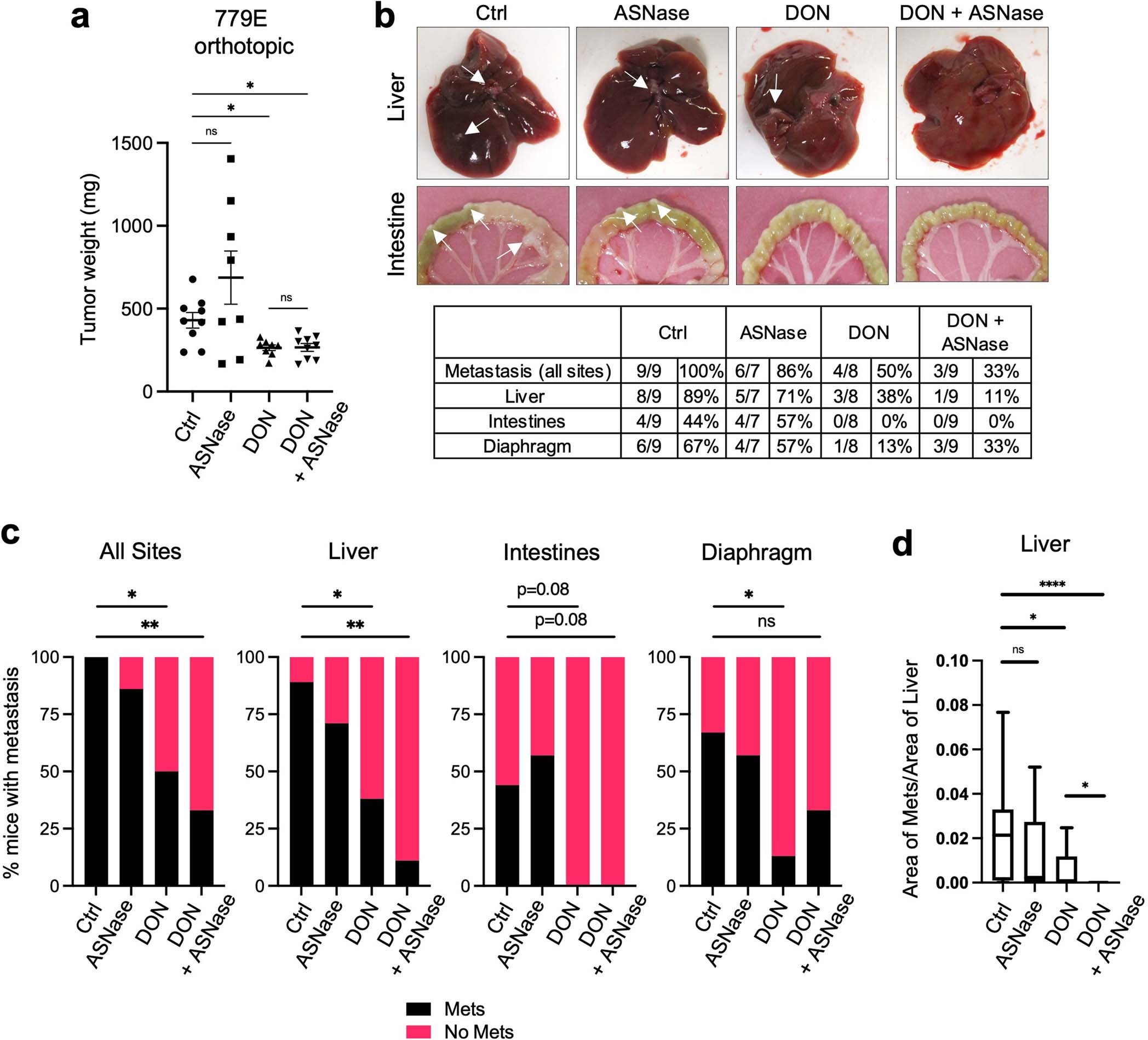 Extended Data Fig. 9: Suppression of metastasis by DON is enhanced by co-treatment with ASNase in a primary PDAC orthotopic mouse model.