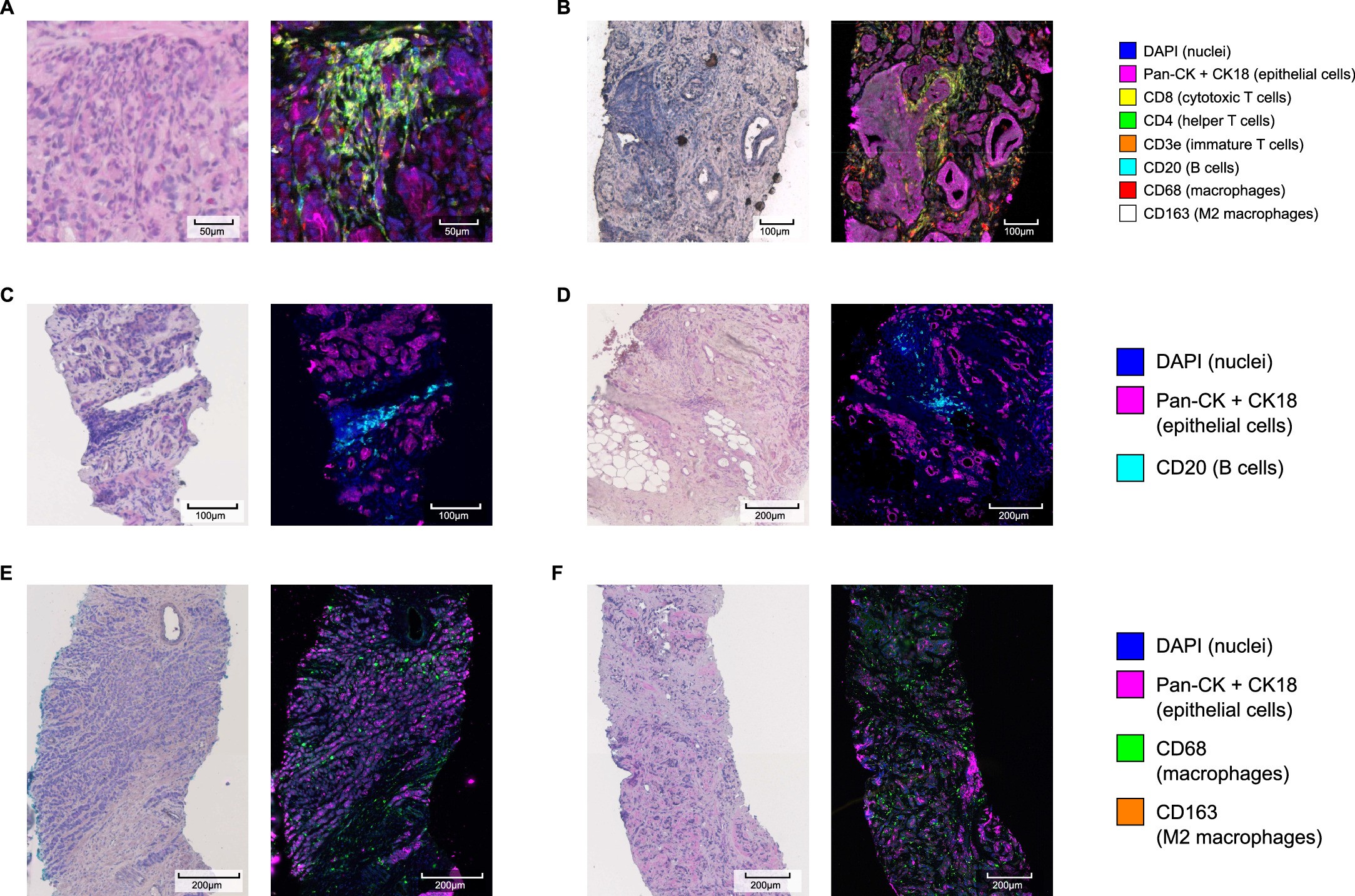 Extended Data Fig. 10: Supplementary examples of immune profiles in the multiplex immunohistochemistry cohort.