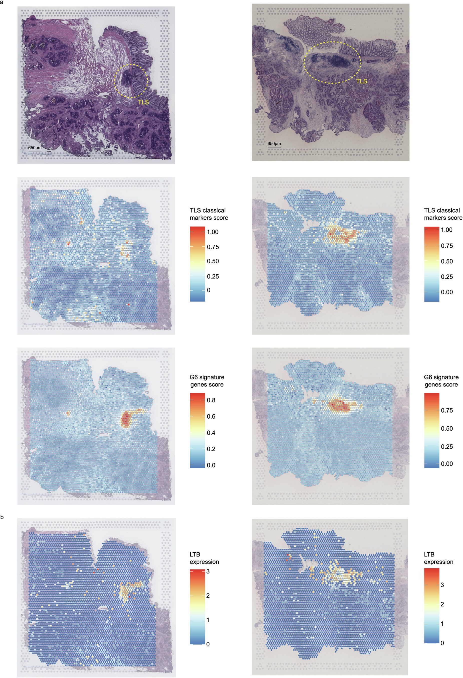 Extended Data Fig. 9: TLS characterization by spatial transcriptome.