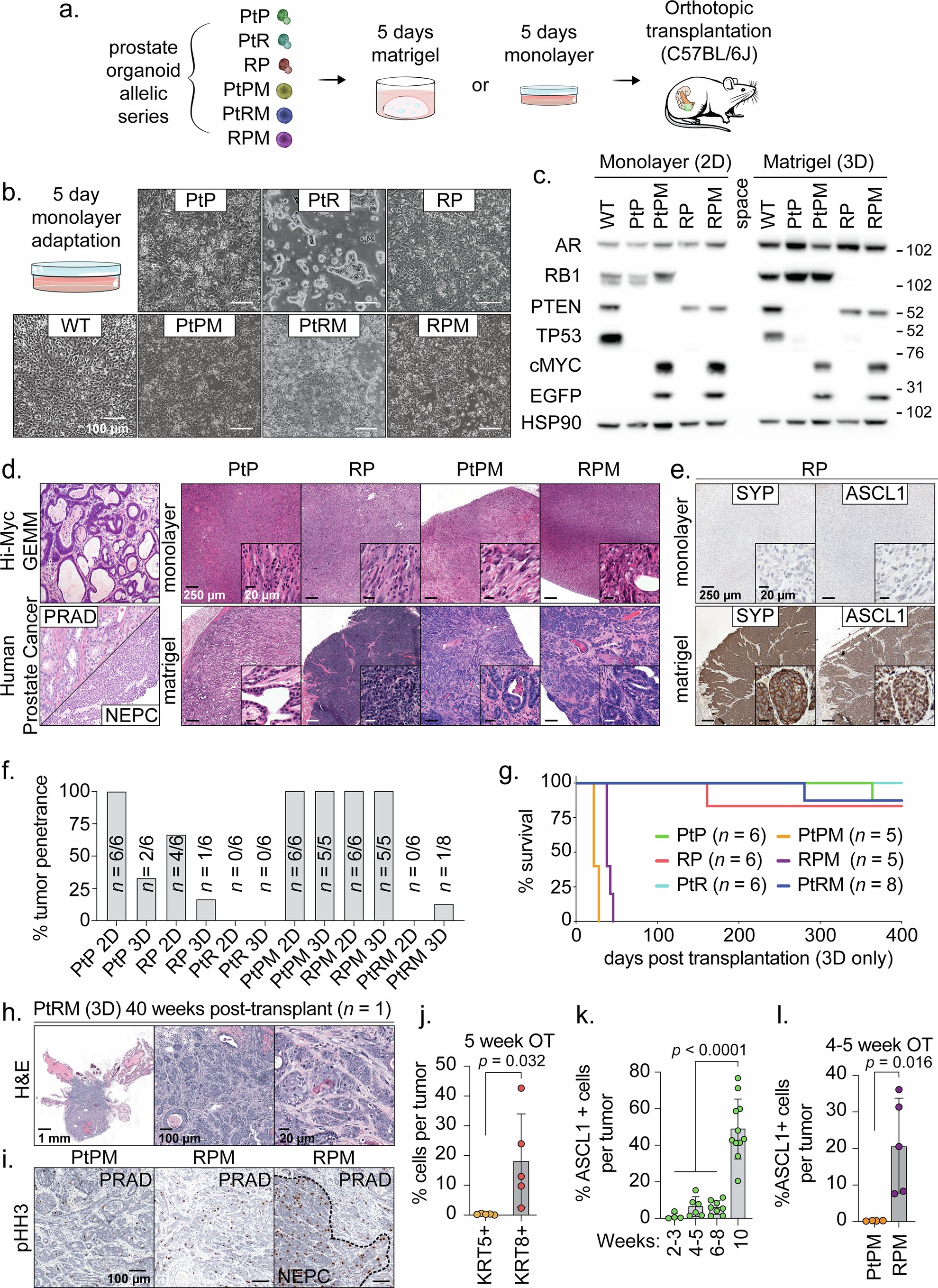 Extended Data Fig. 2: Transplantation of 3D, but not 2D, cultured mouse organoids maintain PRAD histology and marker profiles.
