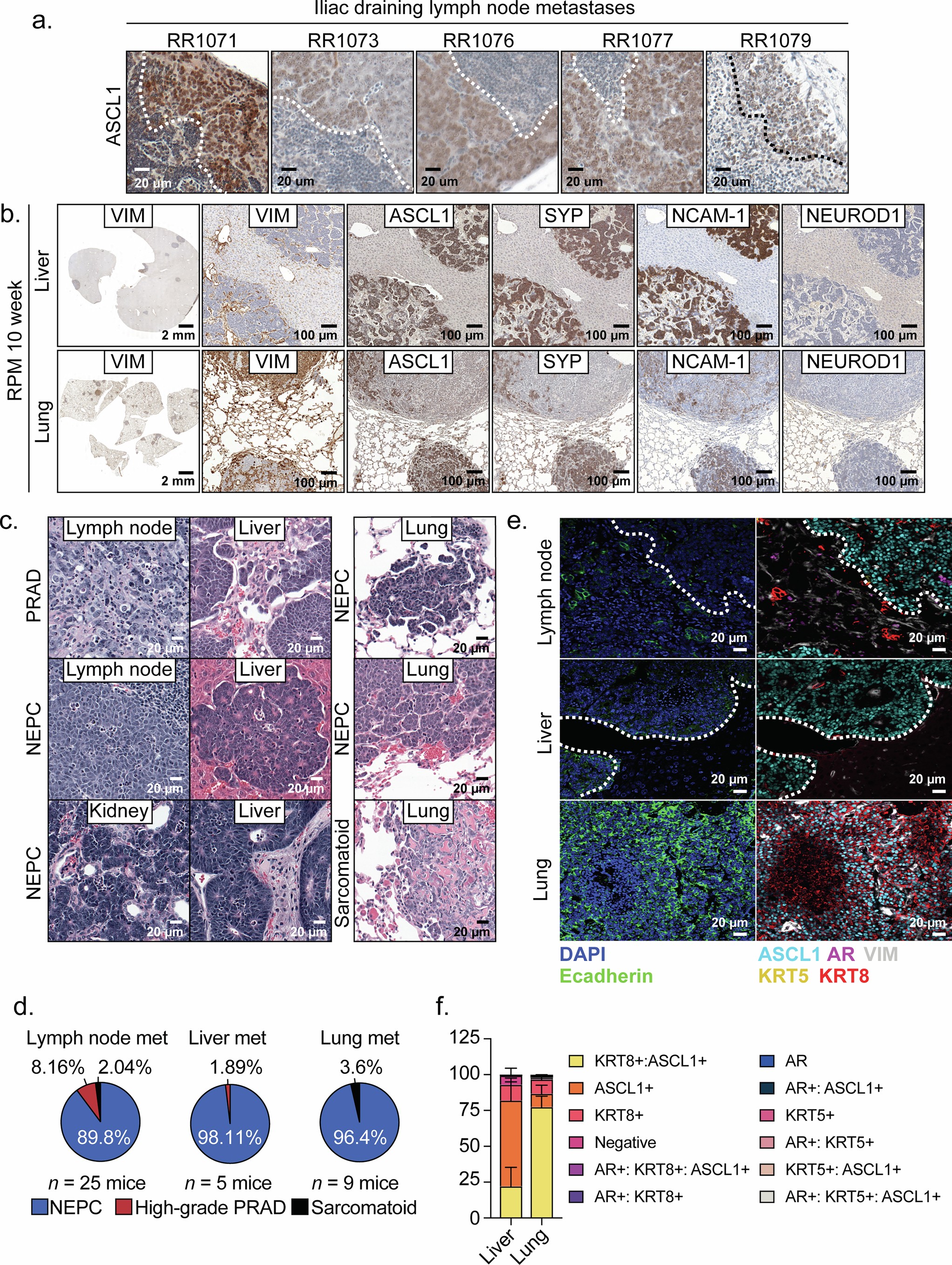 Extended Data Fig. 3: Metastatic tumors in RPM model establish with high penetrance NEPC histology and marker profile.