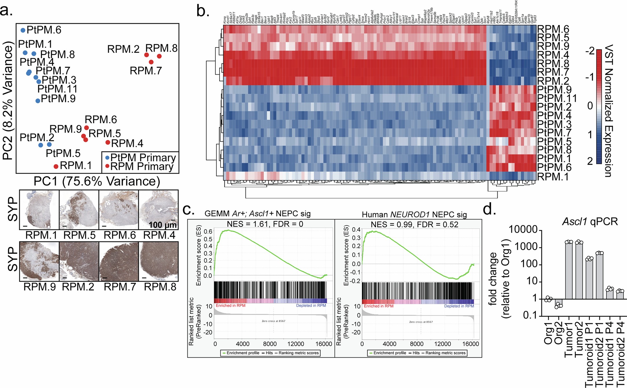 Extended Data Fig. 4: Bulk gene expression profiling of mouse tumors highlights the requirement for Rb1 loss and the TME to induce and maintain NEPC fate.