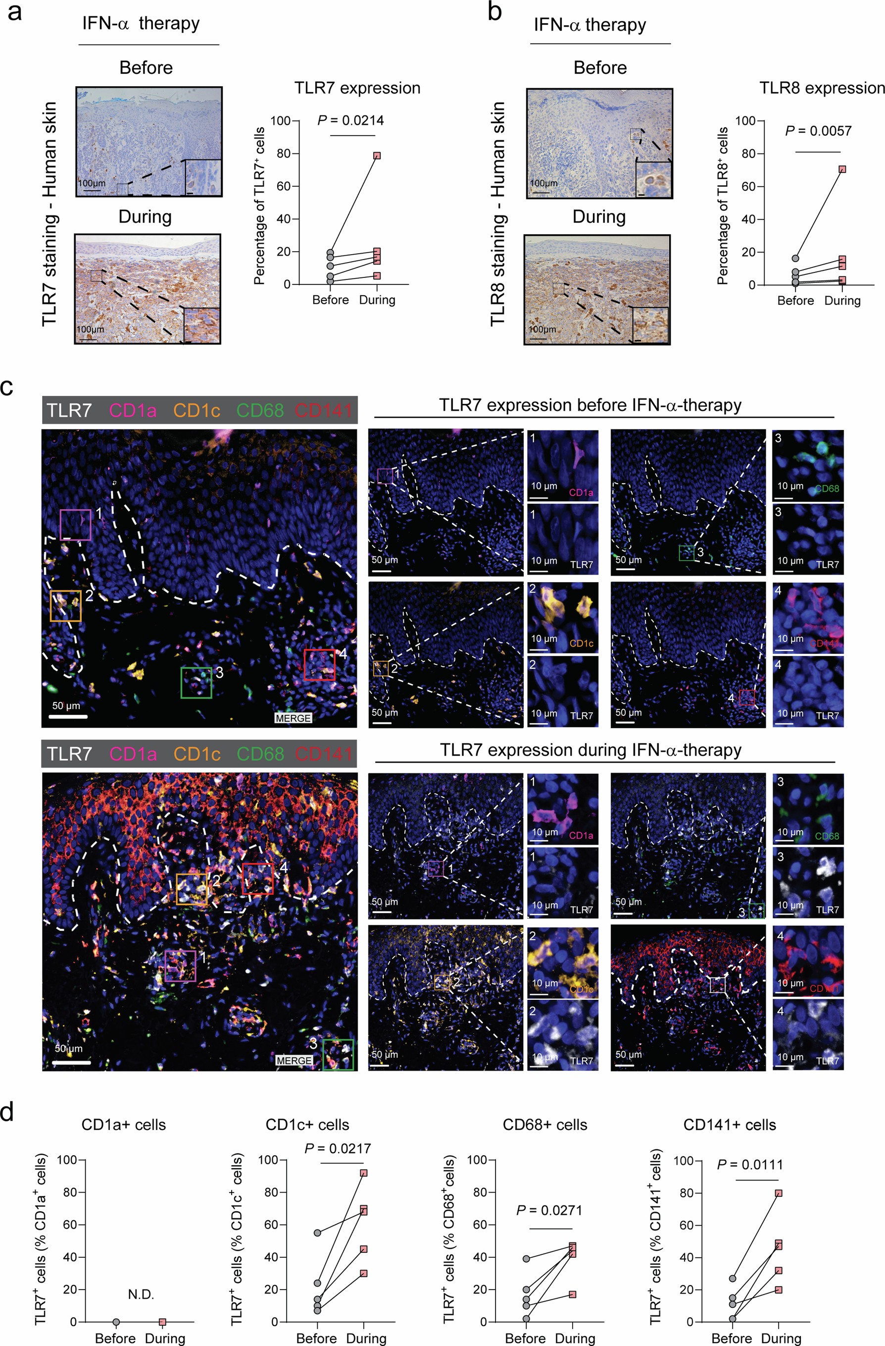 Extended Data Fig. 4: IFN-α therapy induces TLR7 on myeloid cells in tumor stroma.
