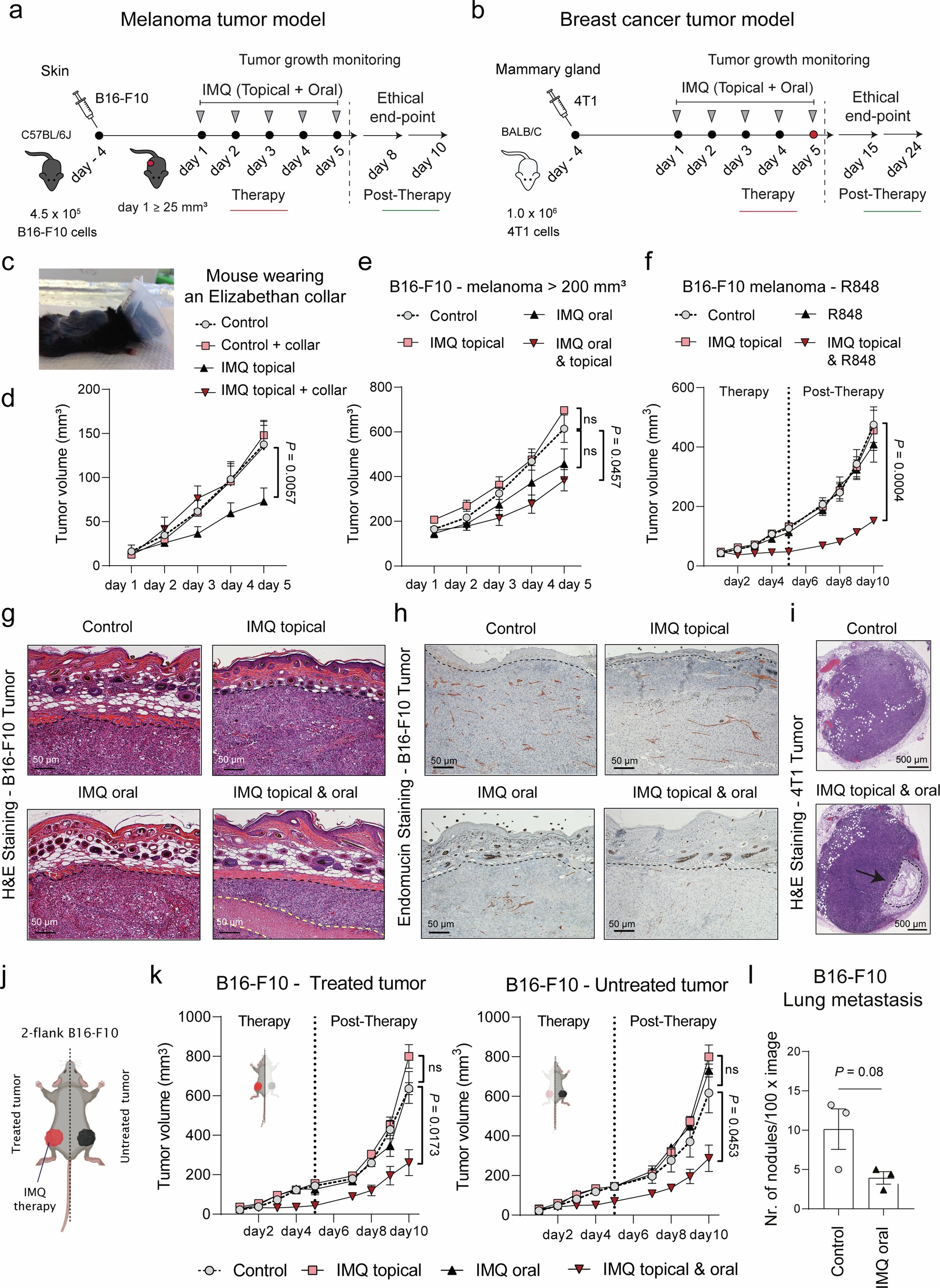 Extended Data Fig. 1: Oral and topical IMQ therapy induces tumor regression with necrosis.