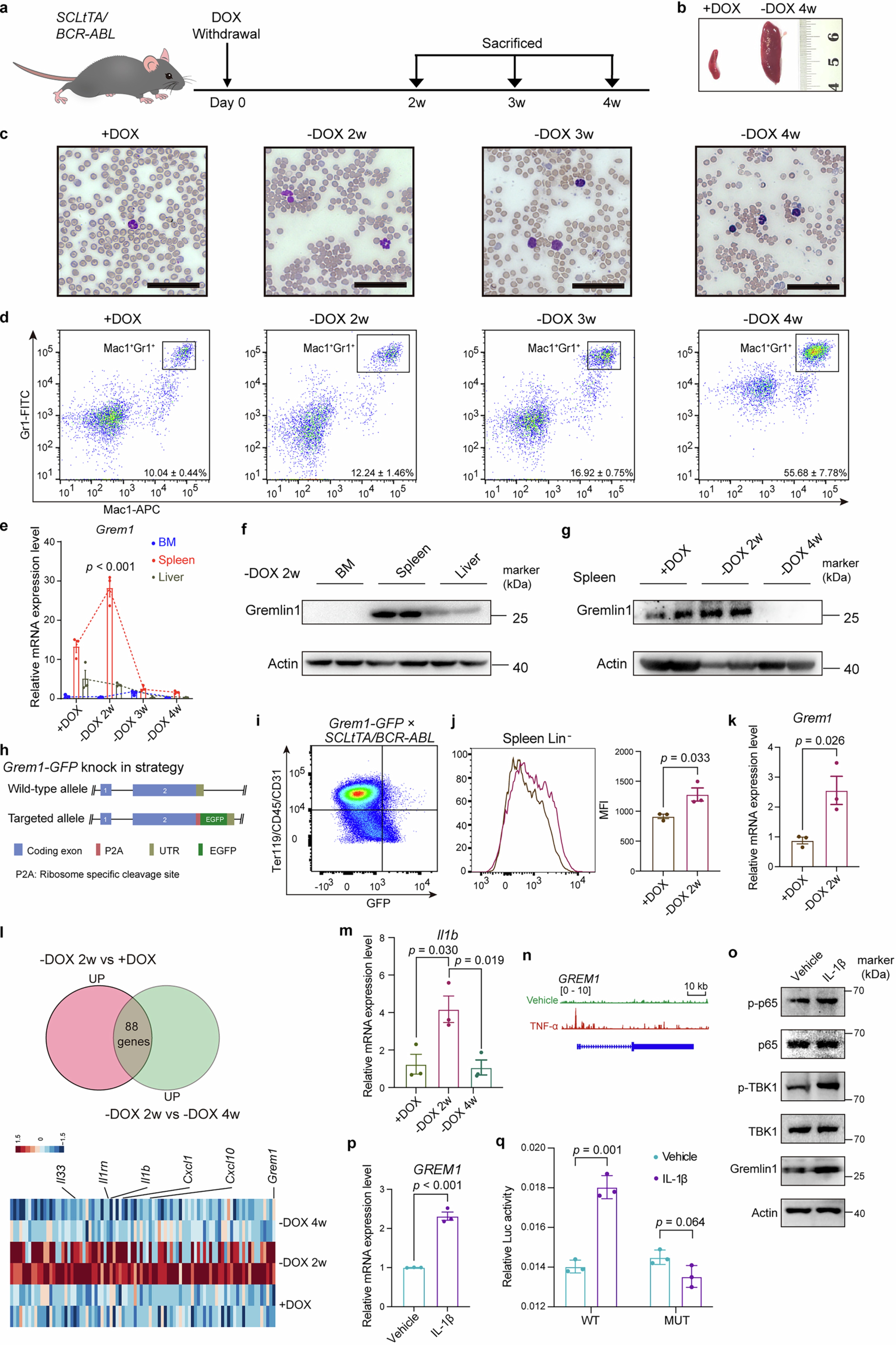 Extended Data Fig. 1: Grem1 is dynamically expressed in the spleen during CML progression and is positively regulated by the IL-1β/NFκB signaling pathway.