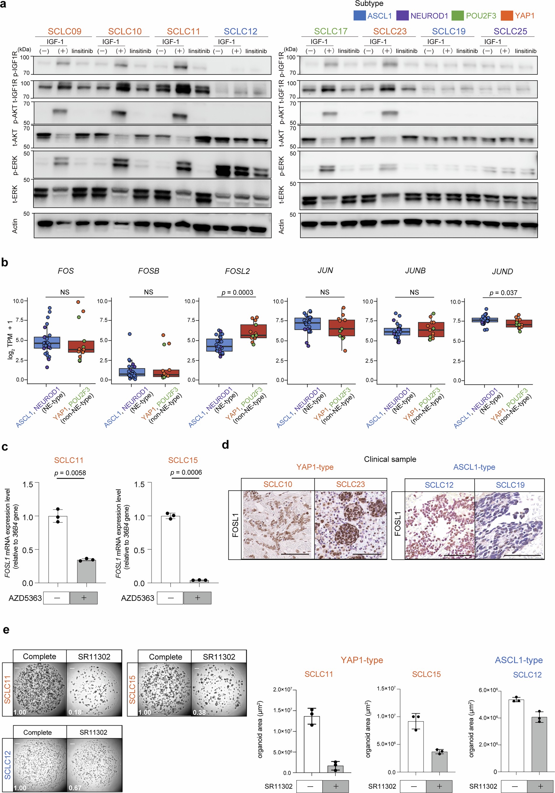 Extended Data Fig. 7: IGF1R and downstream activation in YAP1-subtype SCLC organoids.