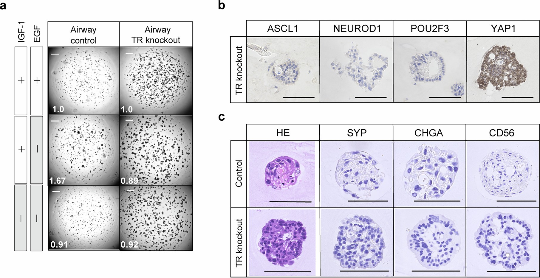 Extended Data Fig. 10: TP53/RB1 knockout in human normal airway organoids.