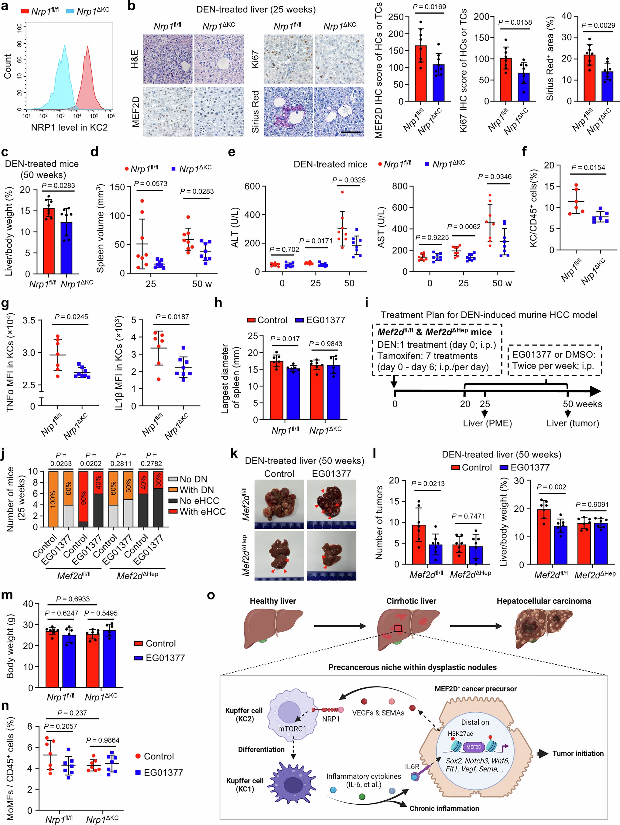 Extended Data Fig. 10: NRP1 deletion in KCs reduces KC2-to-KC1-like conversion to attenuate pro-inflammatory status of the precancerous niche, hindering progression of MEF2D+ precursor cells.