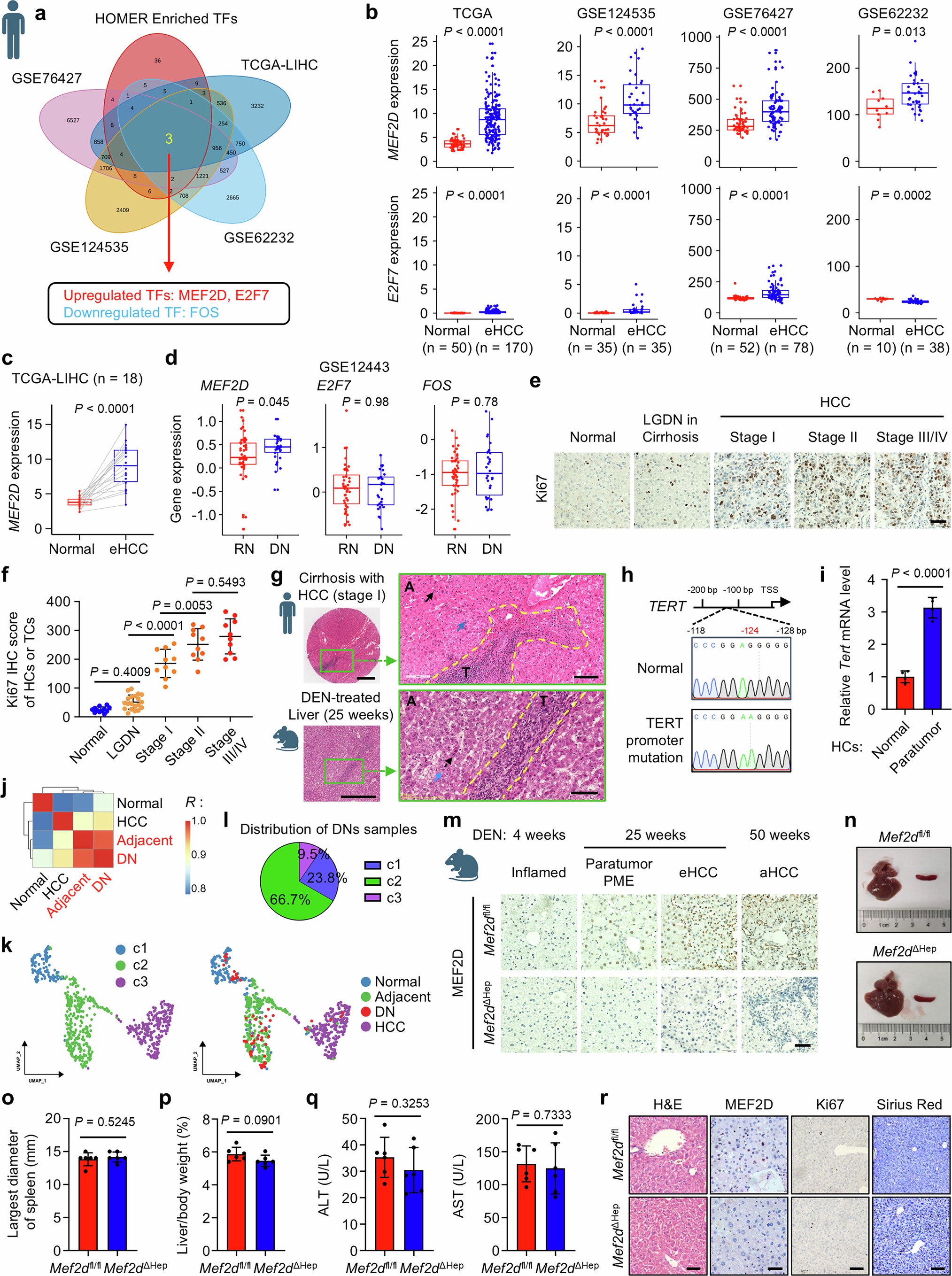 Extended Data Fig. 1: Increased level of MEF2D+ hepatocytes promotes liver tumorigenesis.