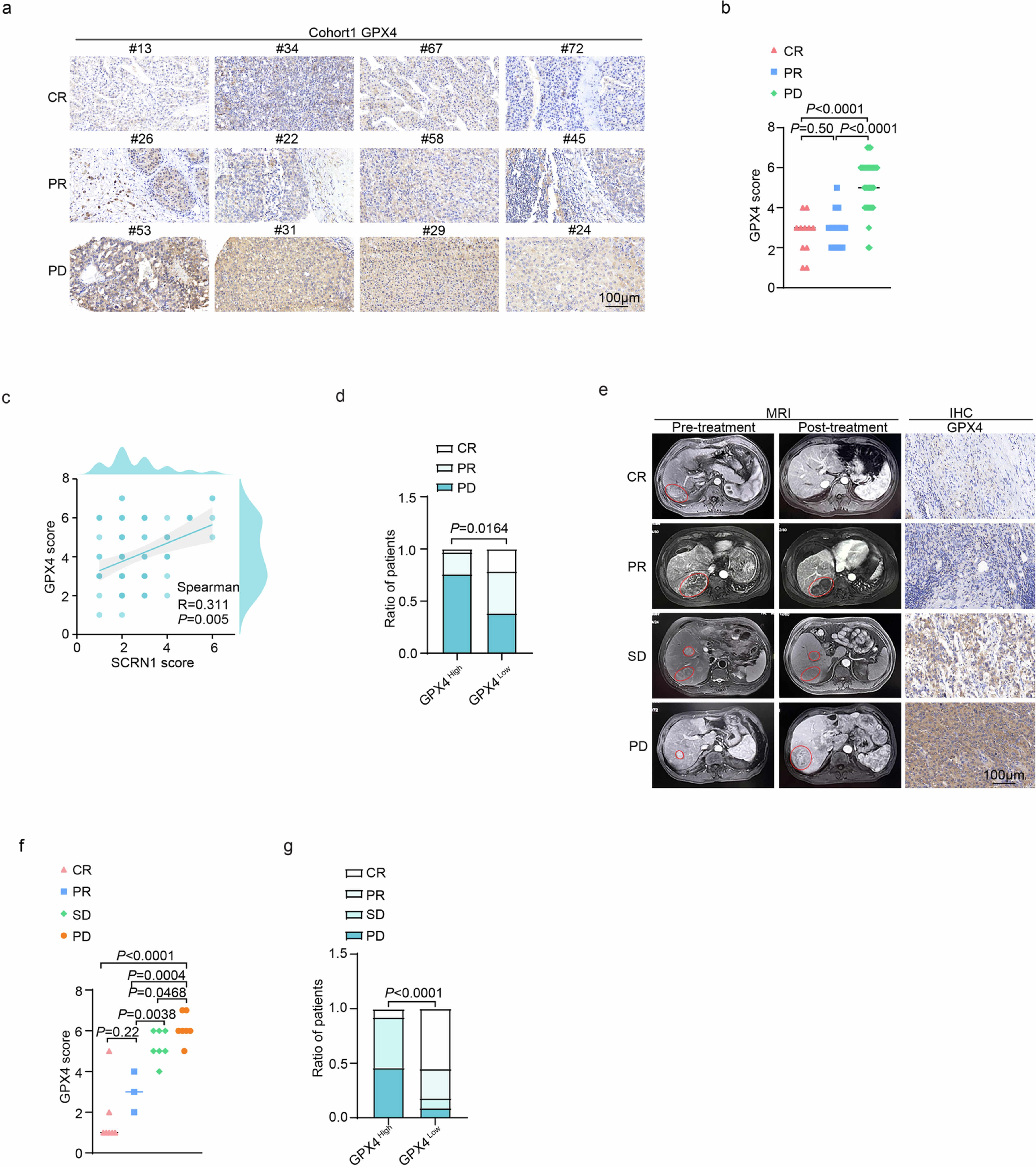 Extended Data Fig. 9: GPX4 phosphorylation correlated with sorafenib resistance.