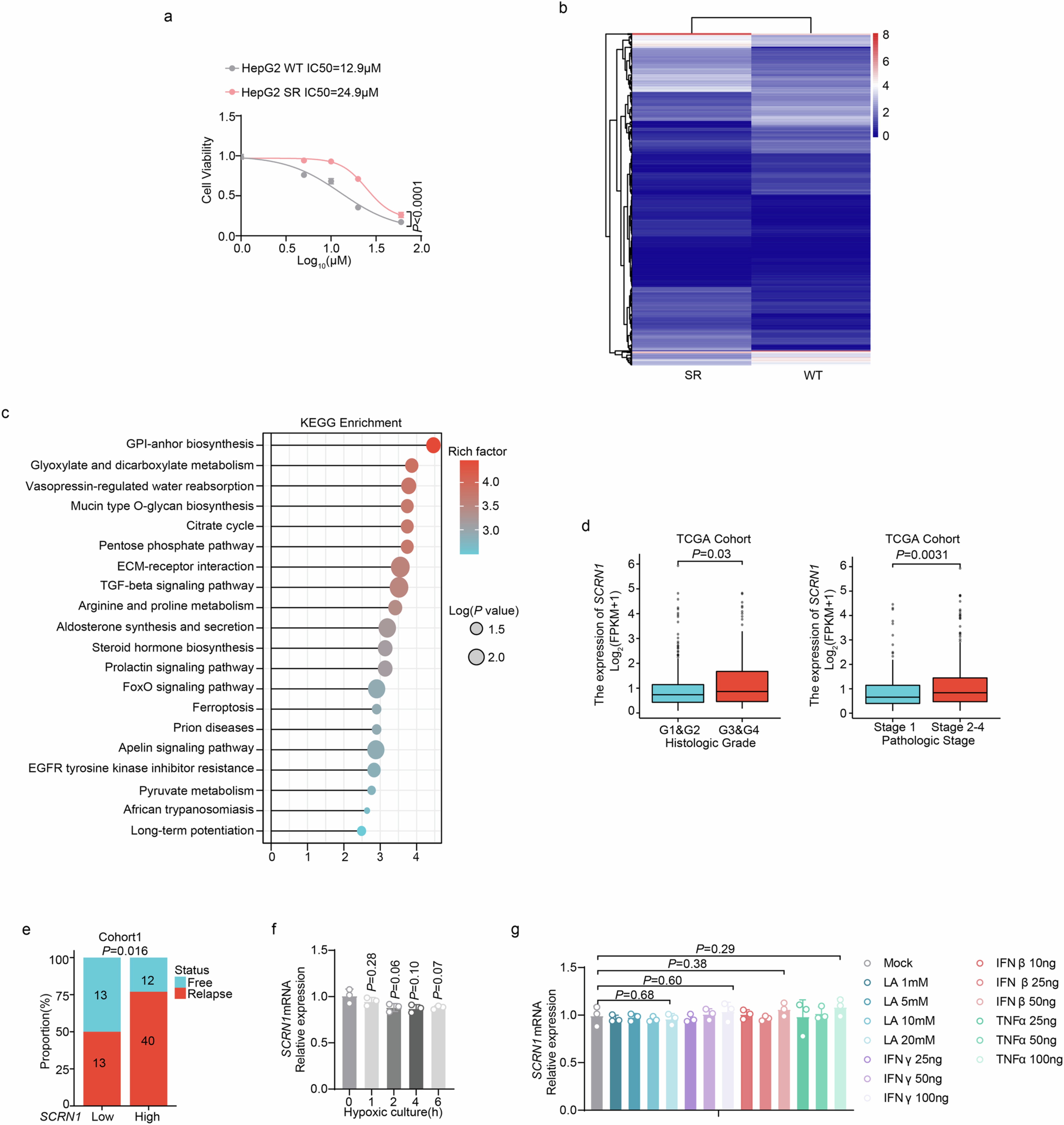 Extended Data Fig. 1: SCRN1 is associated with sorafenib resistance and unfavorable prognosis in HCC patients.