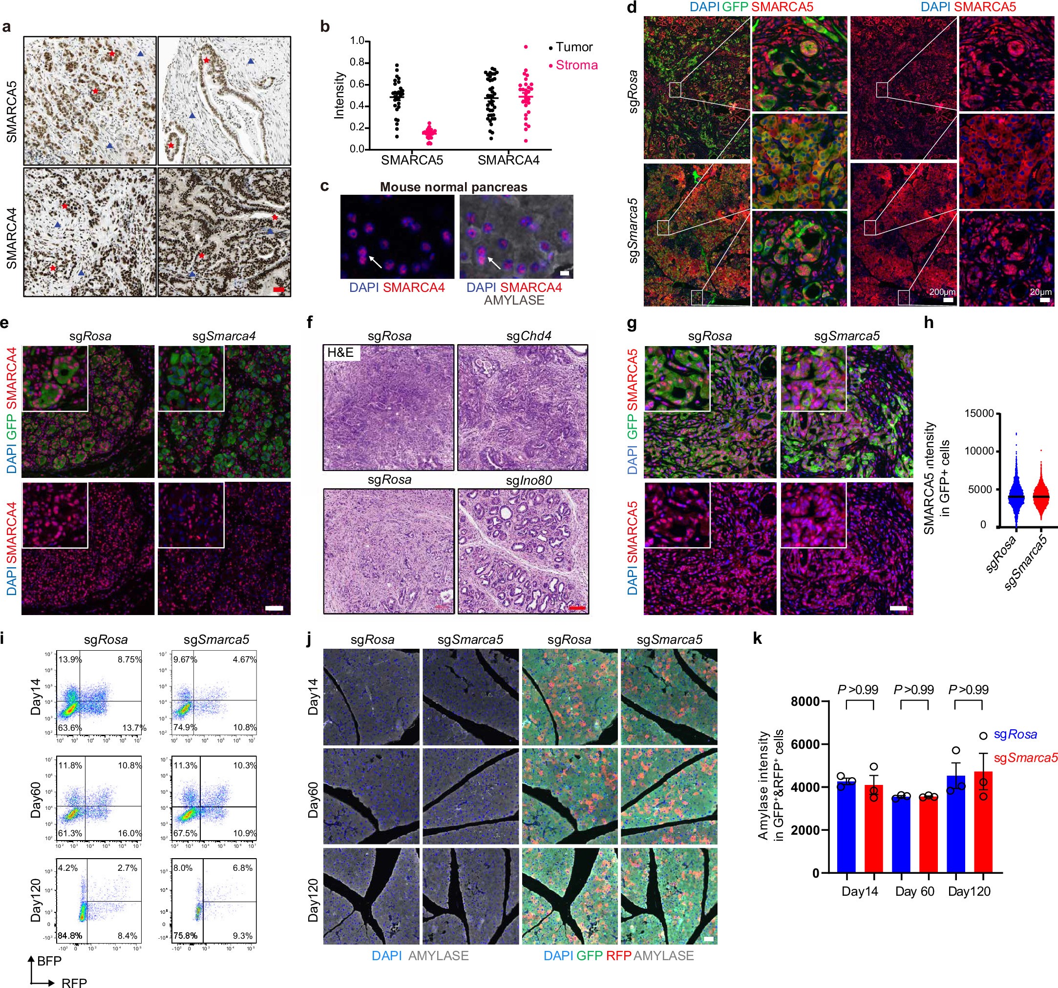 Extended Data Fig. 2: SMARCA5 is a specific regulator of PDAC initiation without affecting normal pancreas.
