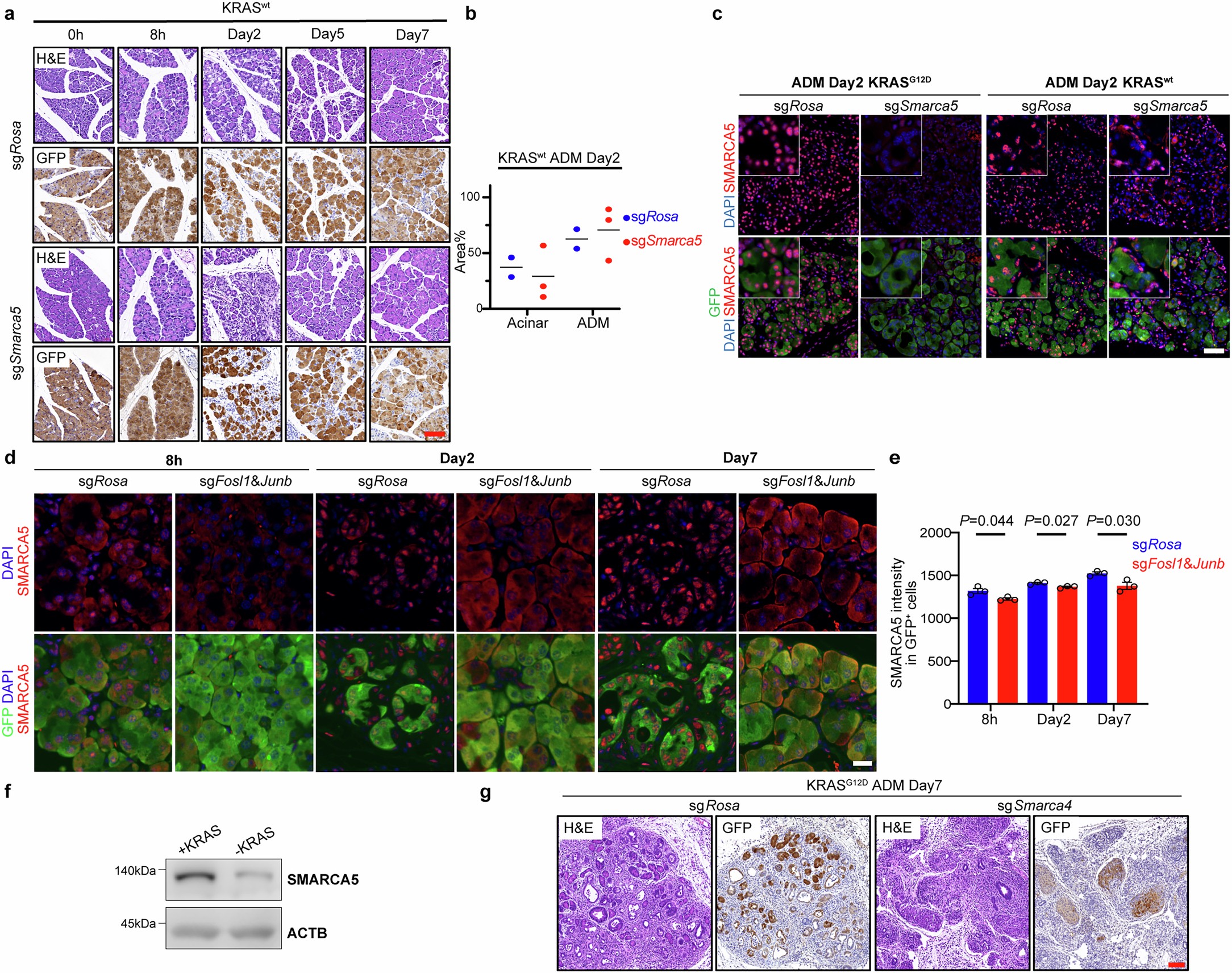 Extended Data Fig. 3: Smarca5 ablation does not affect ADM formation and regeneration in KRASwt context and SMARCA5 is activated by KRAS signaling.
