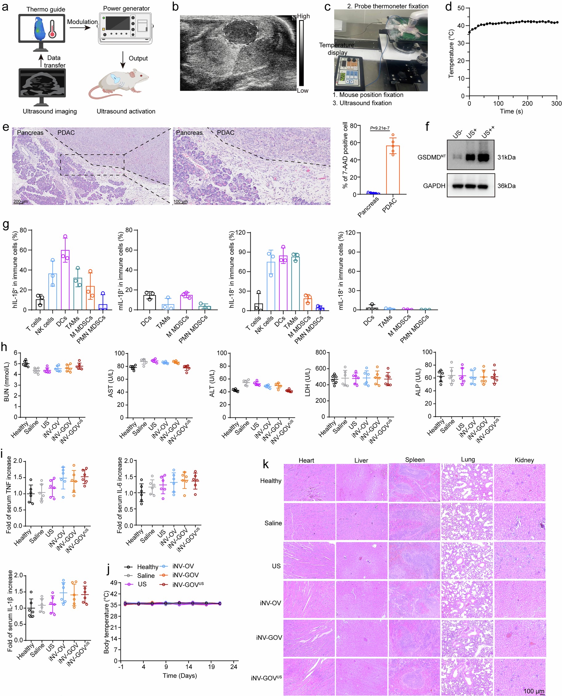 Extended Data Fig. 6: The process and biosafety of ultrasound imaging-guided US-inducible gene activation in vivo.