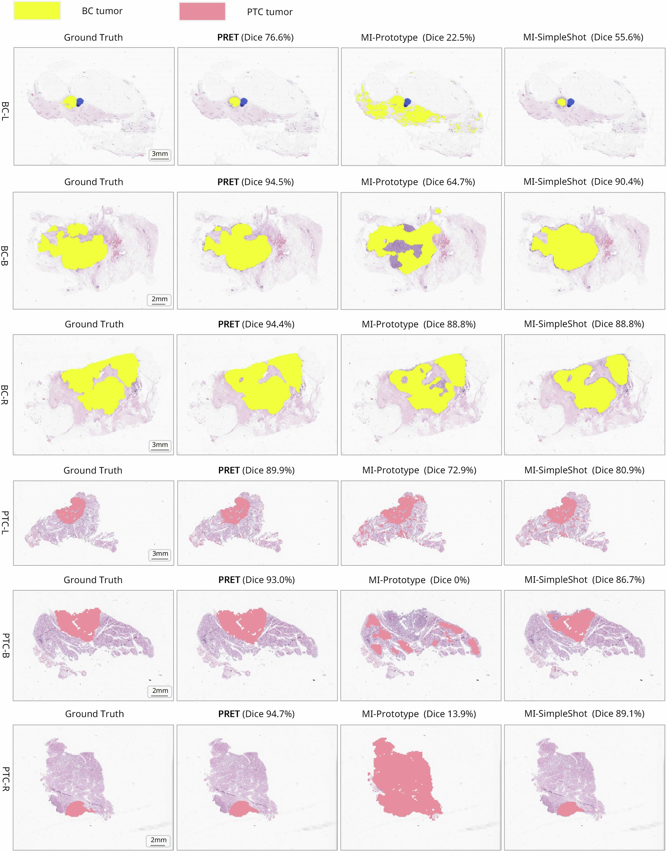Extended Data Fig. 6: Visualization and comparison of tumor segmentation task based on weak visual prompts.