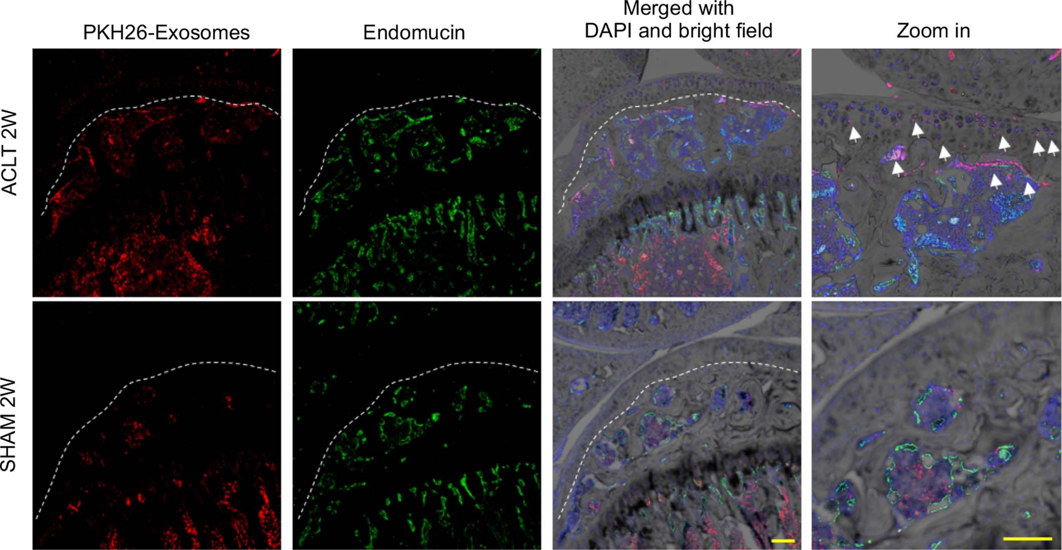 Extended Data Fig. 4: The transfer of OC-exosomes to OA cartilage in vivo.
