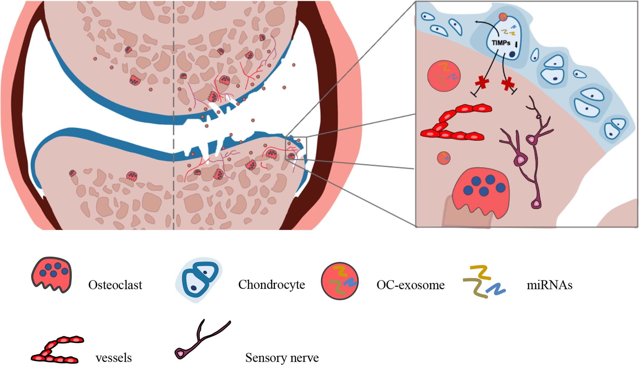Extended Data Fig. 9: Schematic diagram of the osteoclast-chondrocyte crosstalk mediated by osteoclast-derived exosomal miRNA in OA.