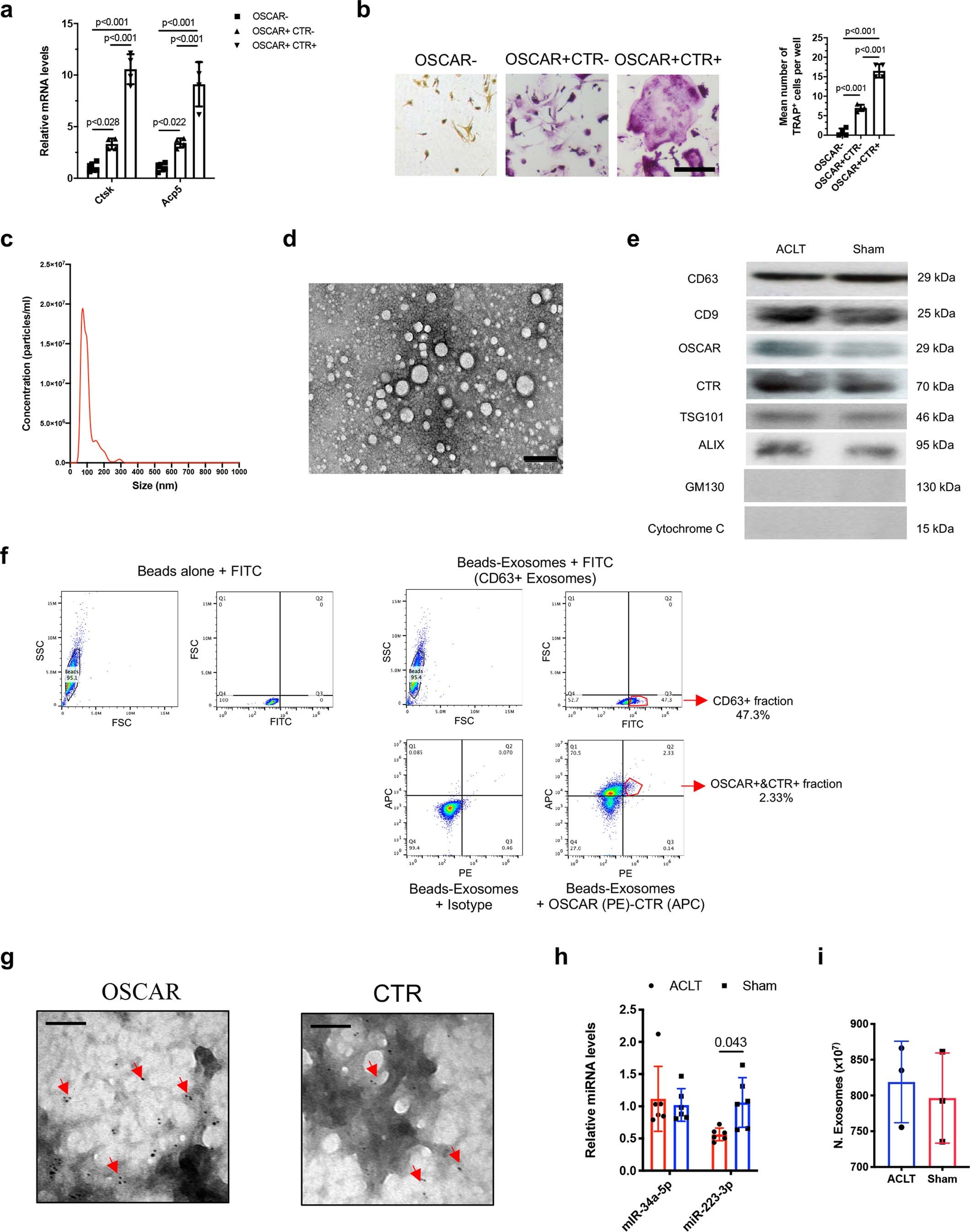 Extended Data Fig. 1: Characterization for bone marrow-derived OCs and serum OC-exosomes.