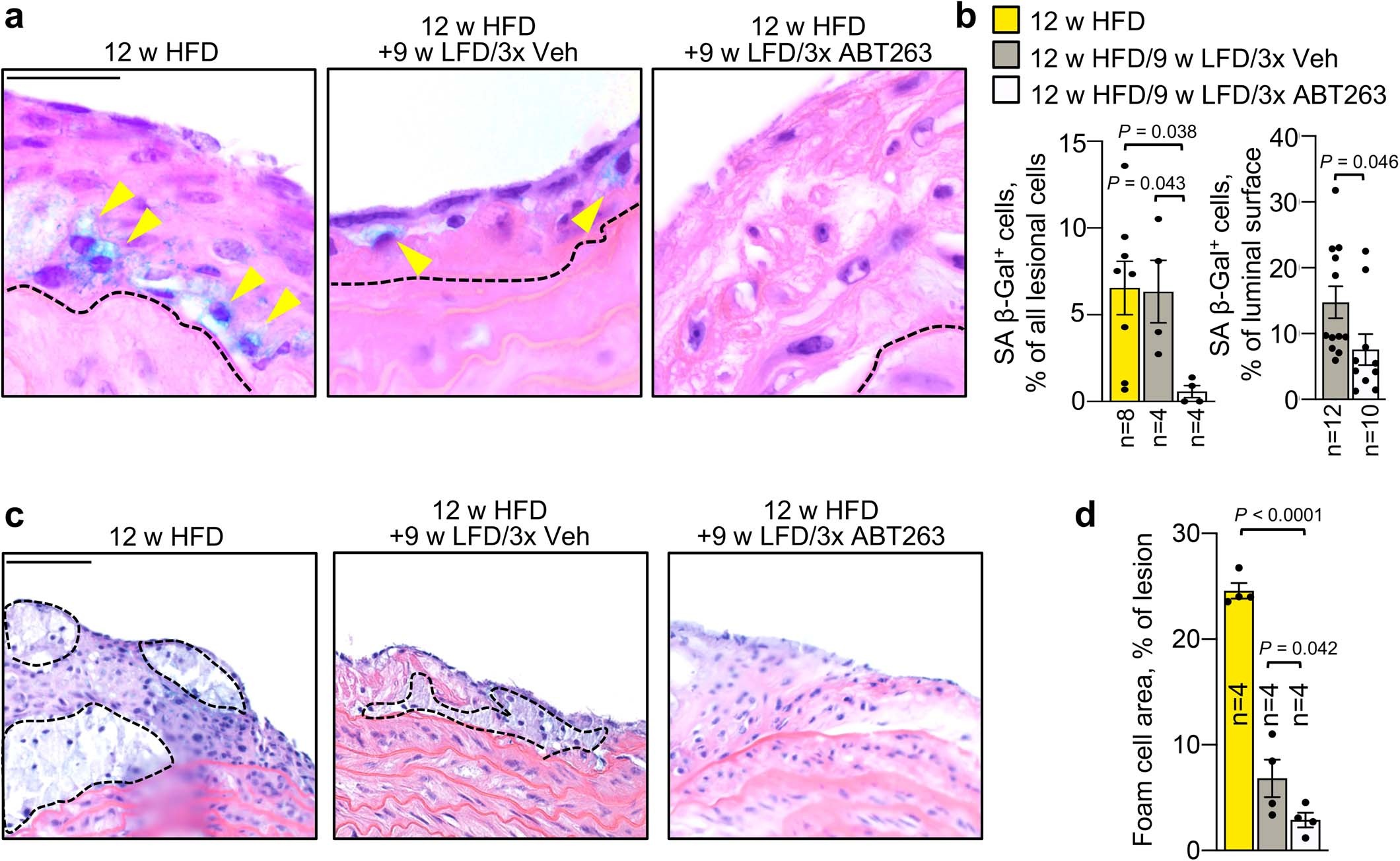 Extended Data Fig. 1: ABT263 depletes SNCs and reduces foam cell macrophage content in intermediate-stage lesions.
