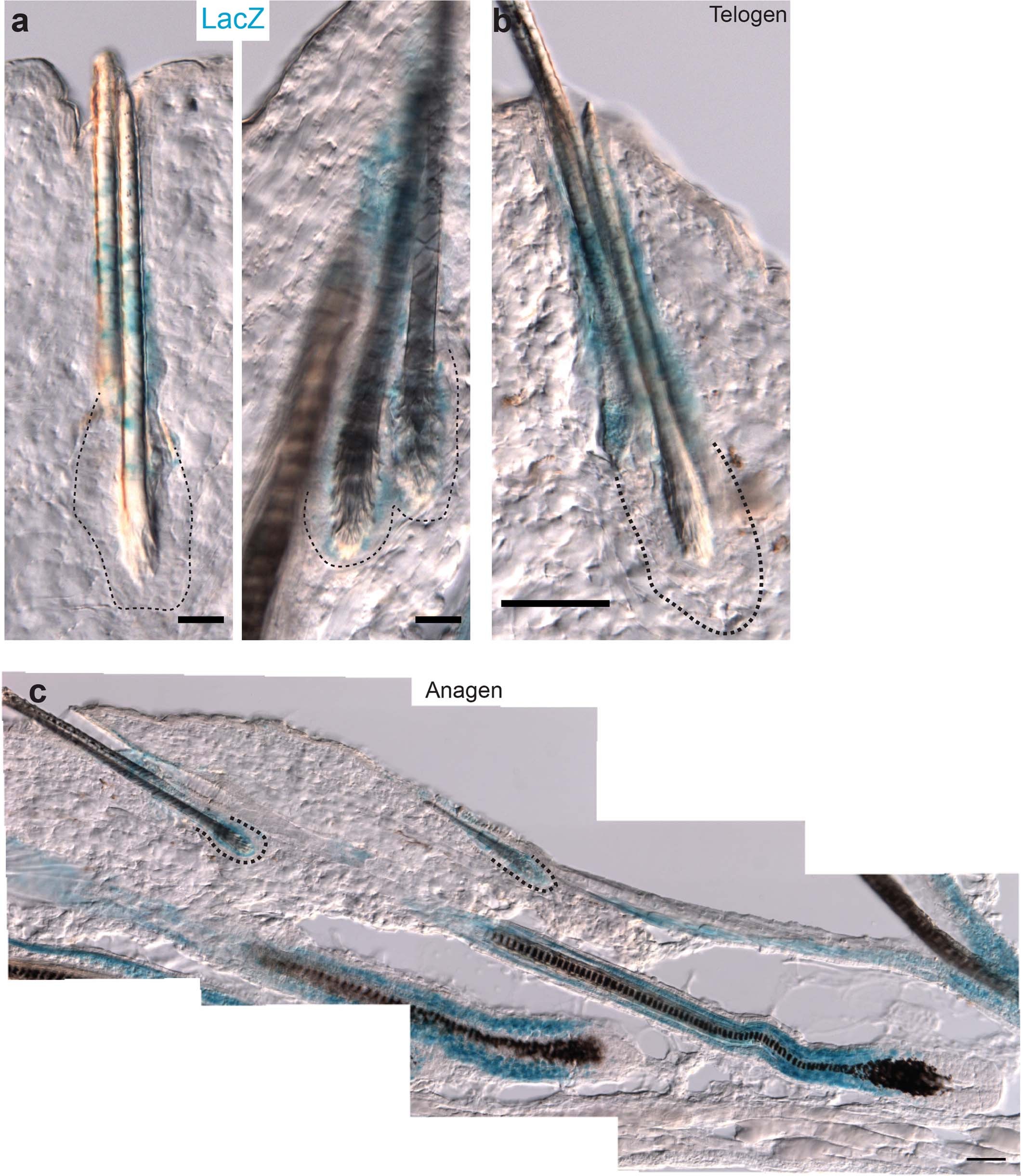 Extended Data Fig. 4: Transcriptional activity of Foxc1 locus in 15mo old mouse skin.