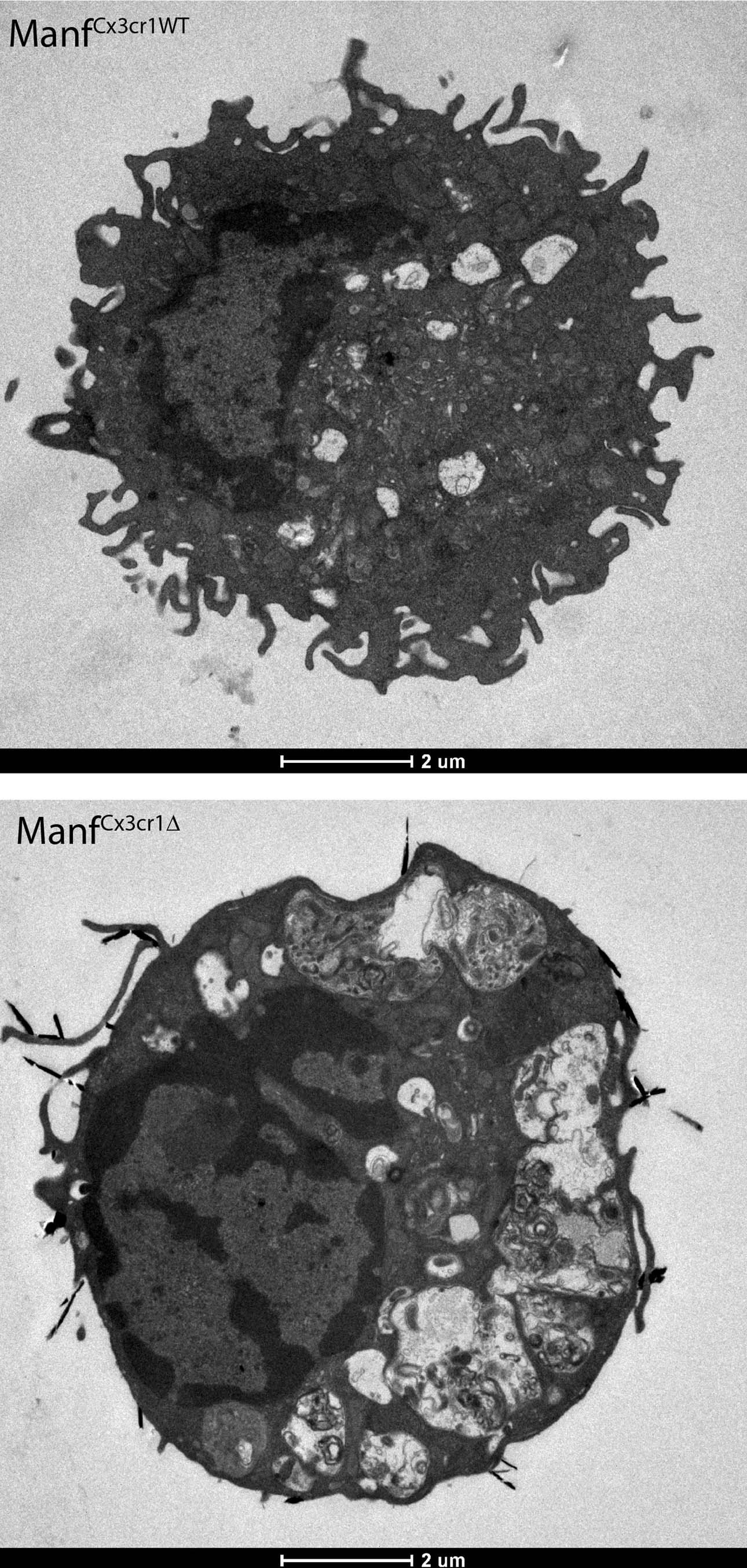 Extended Data Fig. 8: Transmission electron microscopy analysis MANF-deficient and macrophages.