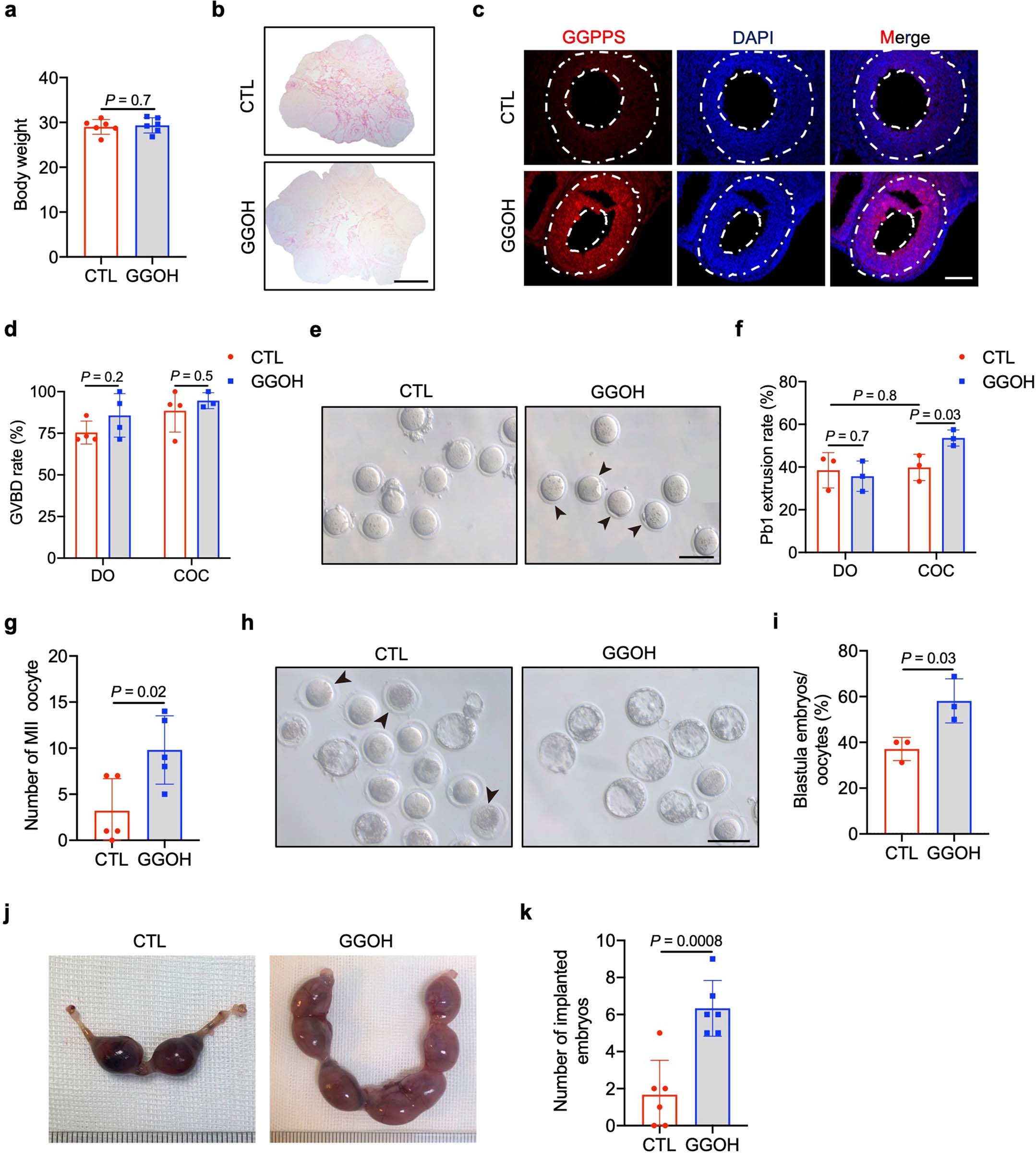 Extended Data Fig. 10: GGOH supplementation improves aged oocyte quality.
